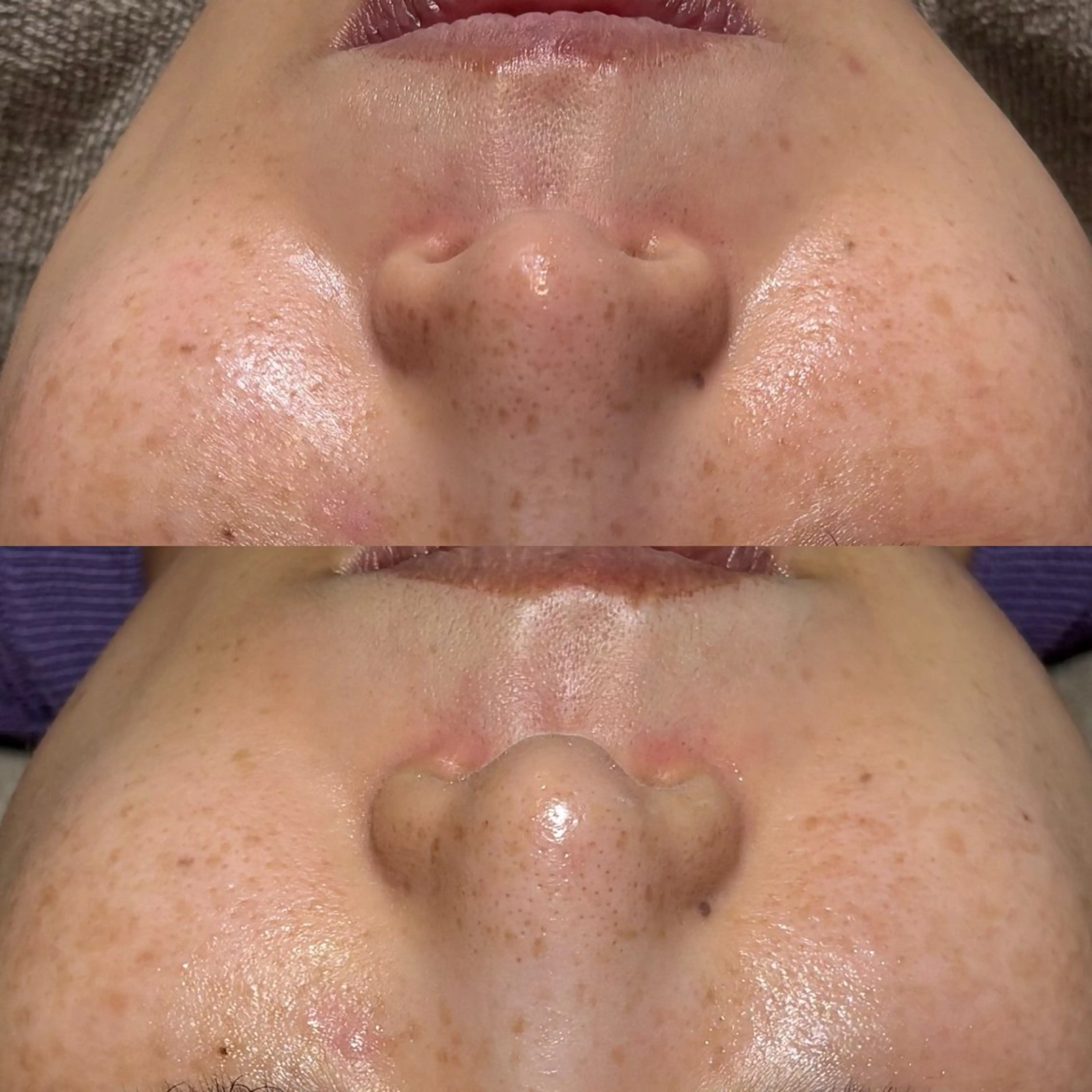 エステ Lassy Yuriの眉毛・アイブロウイメージ