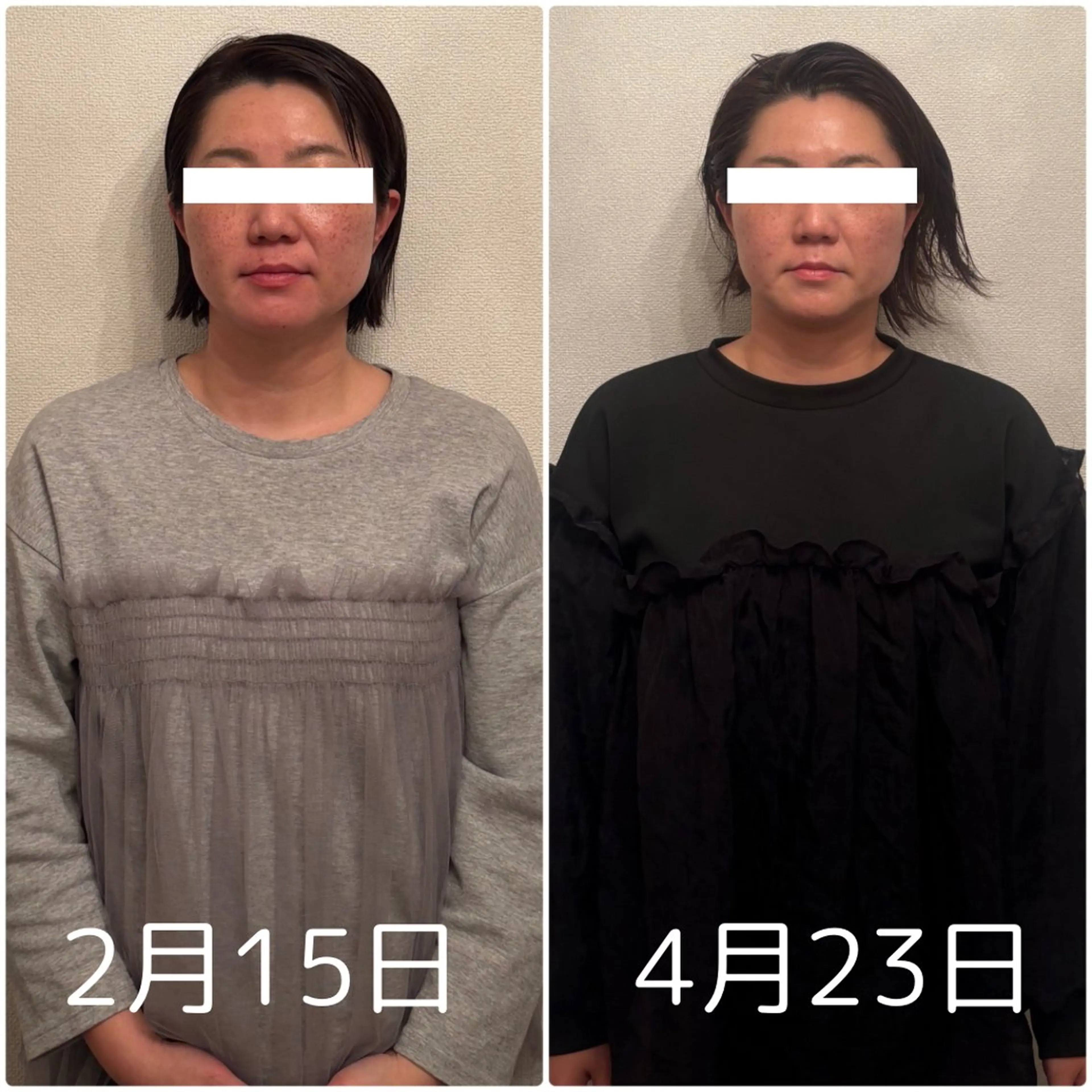 Lily luce 美骨小顔矯正のその他イメージ