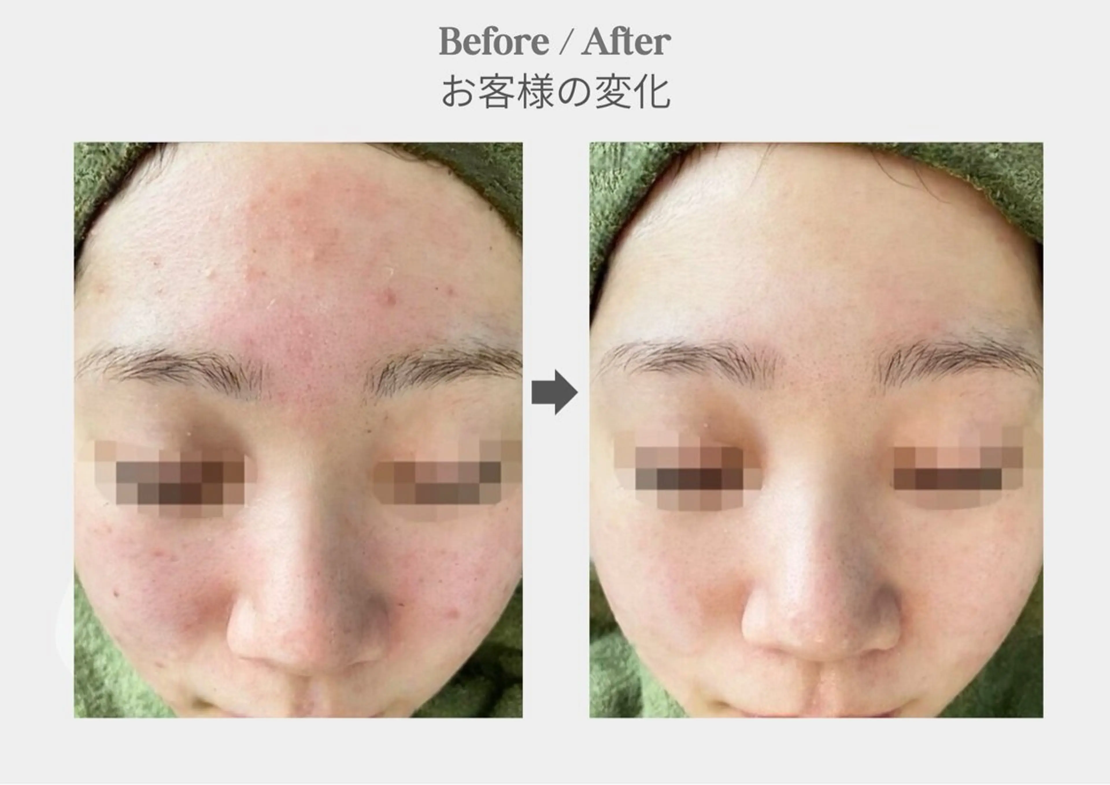 エステ 店長 RUNAのエステ・リラクイメージ