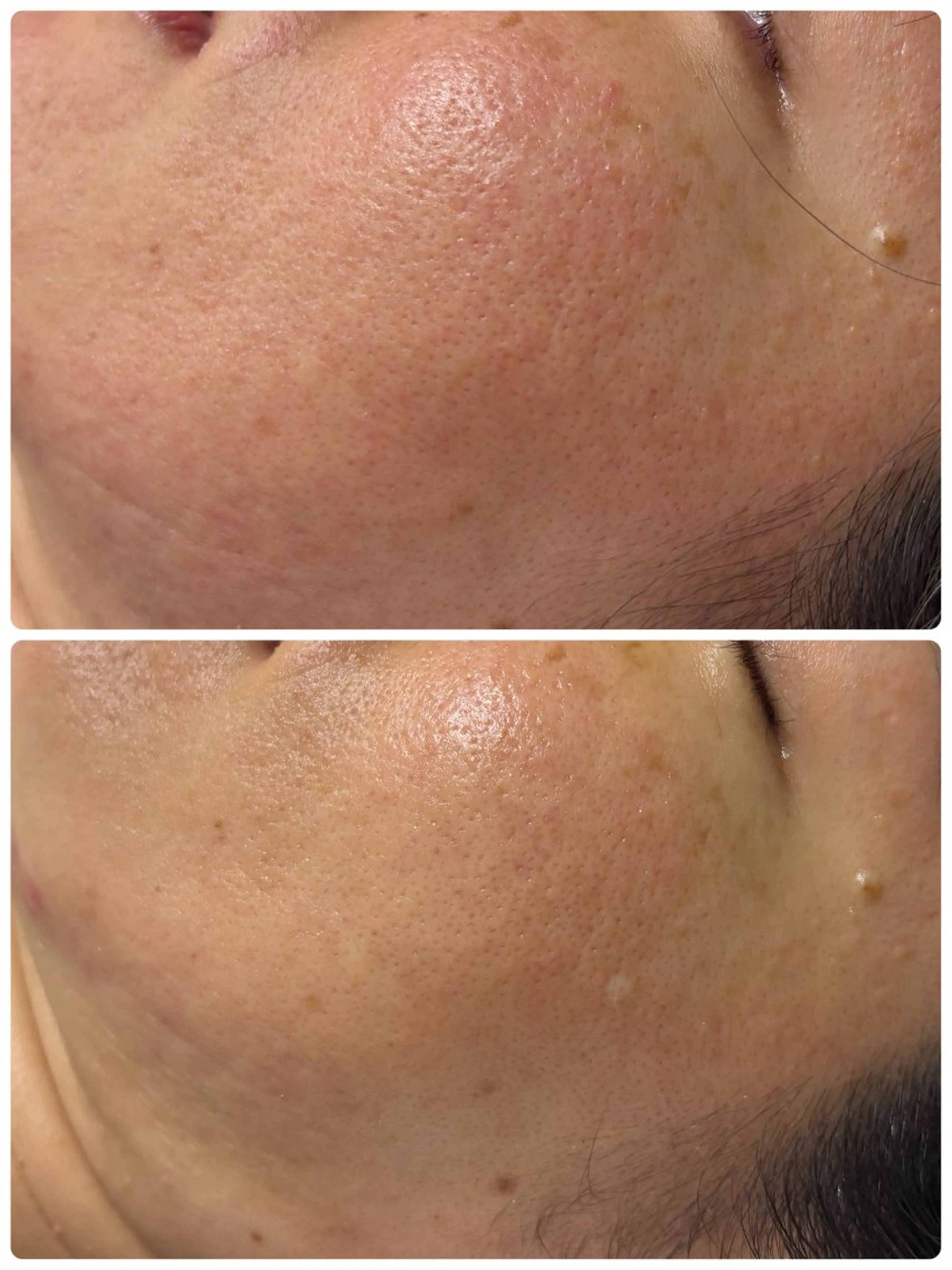 エステ ありな/巡りを整える肌質改善サロン所属・ありな 肌質改善サロンのエステ・リラクイメージ