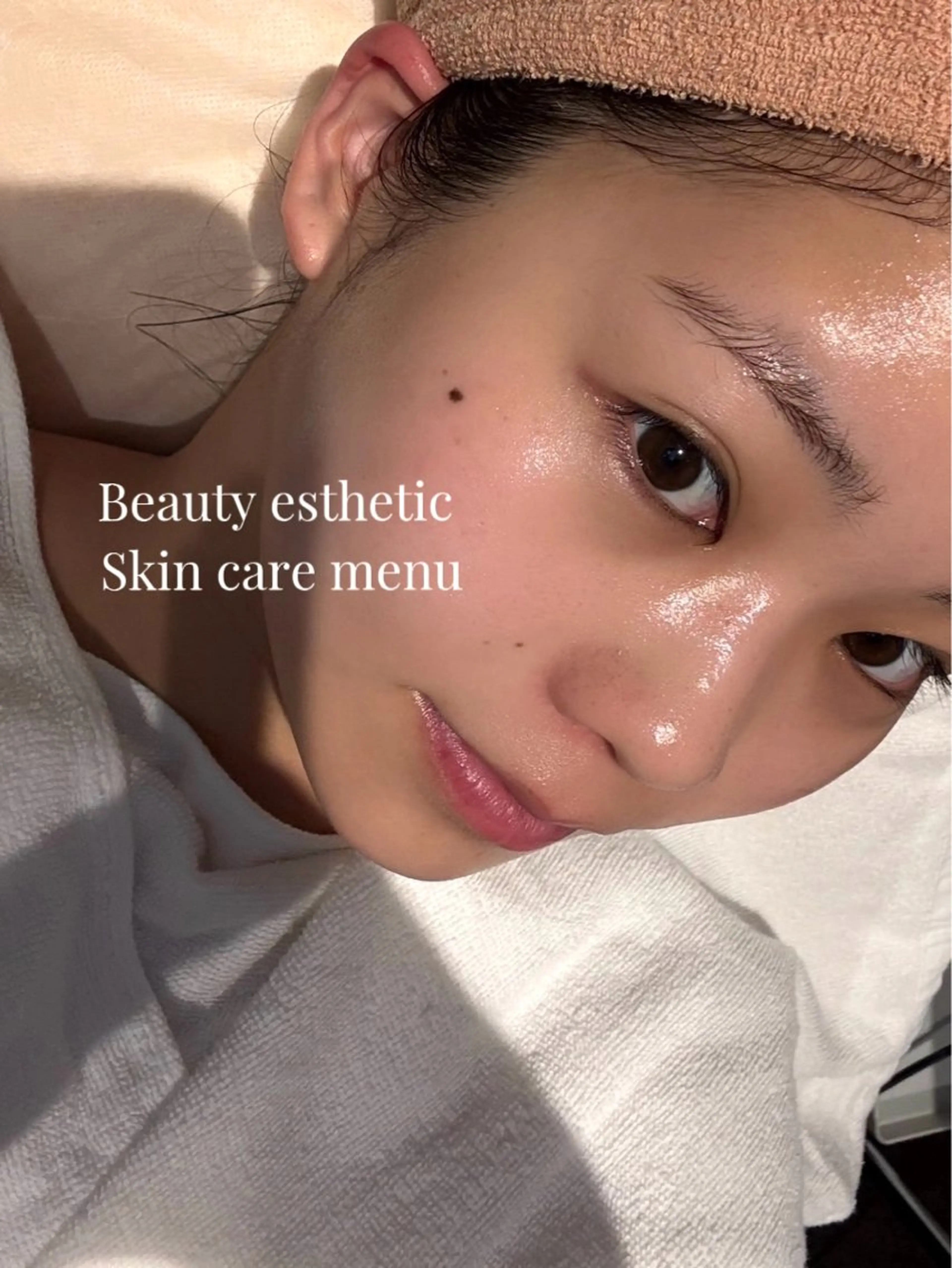 Acne care【ニキビ鎮静】コースの写真