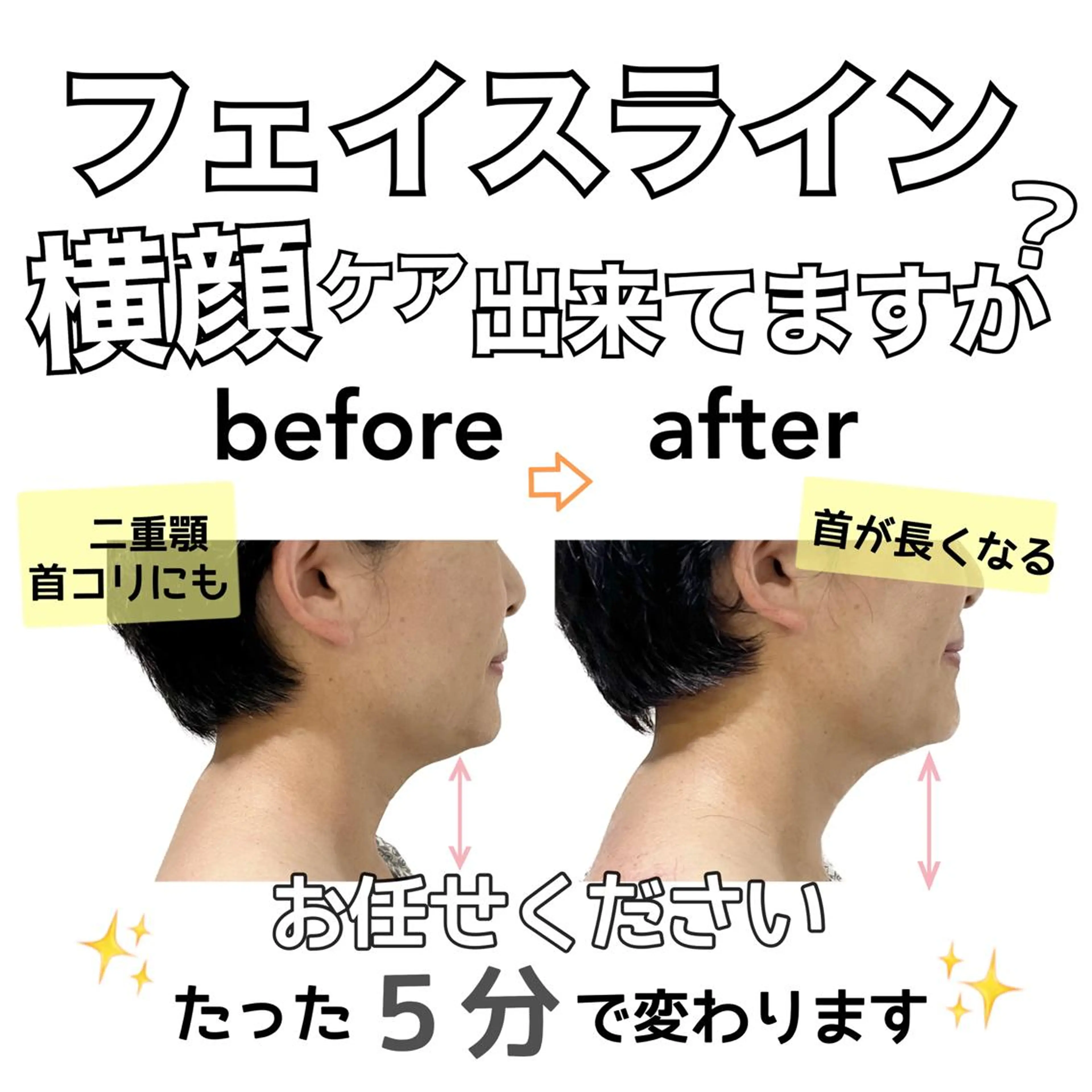 エステ stella所属・stella都度払い 痩身小顔まつげパーマのマツエク・マツパデザイン