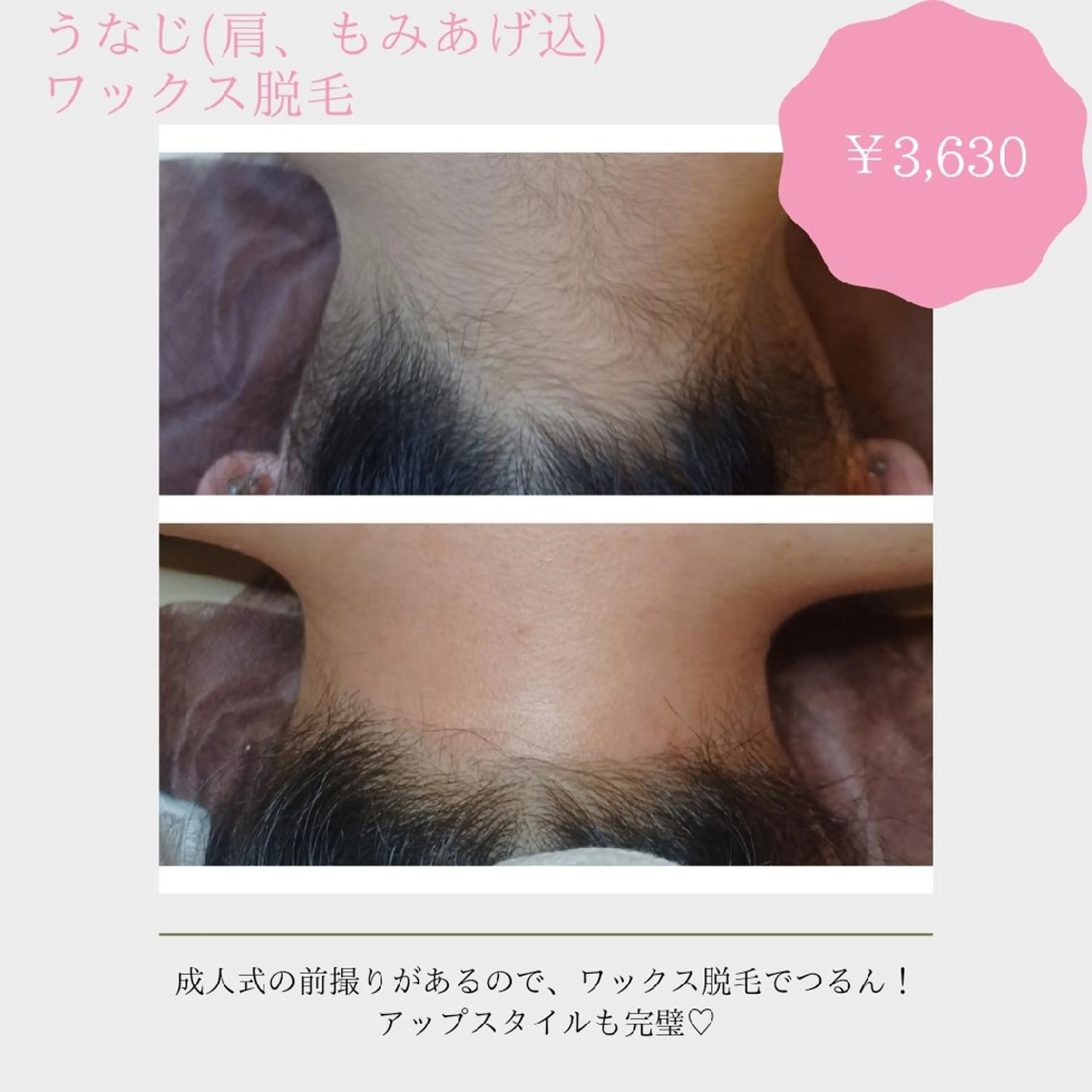 Lutella所属・ワックス脱毛専門店 Lutellaのエステ・リラクイメージ