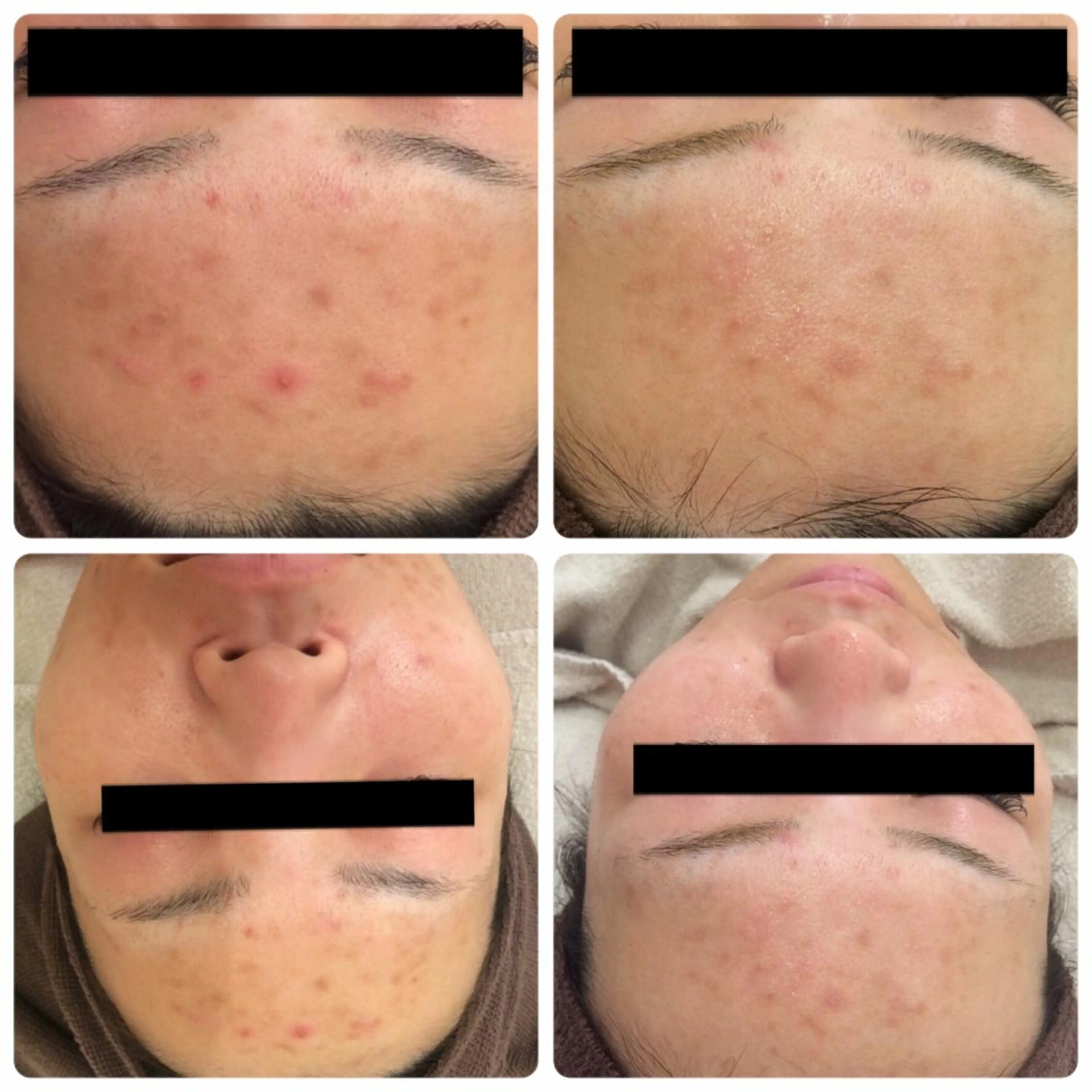 Larin la beauteのエステ・リラクイメージ