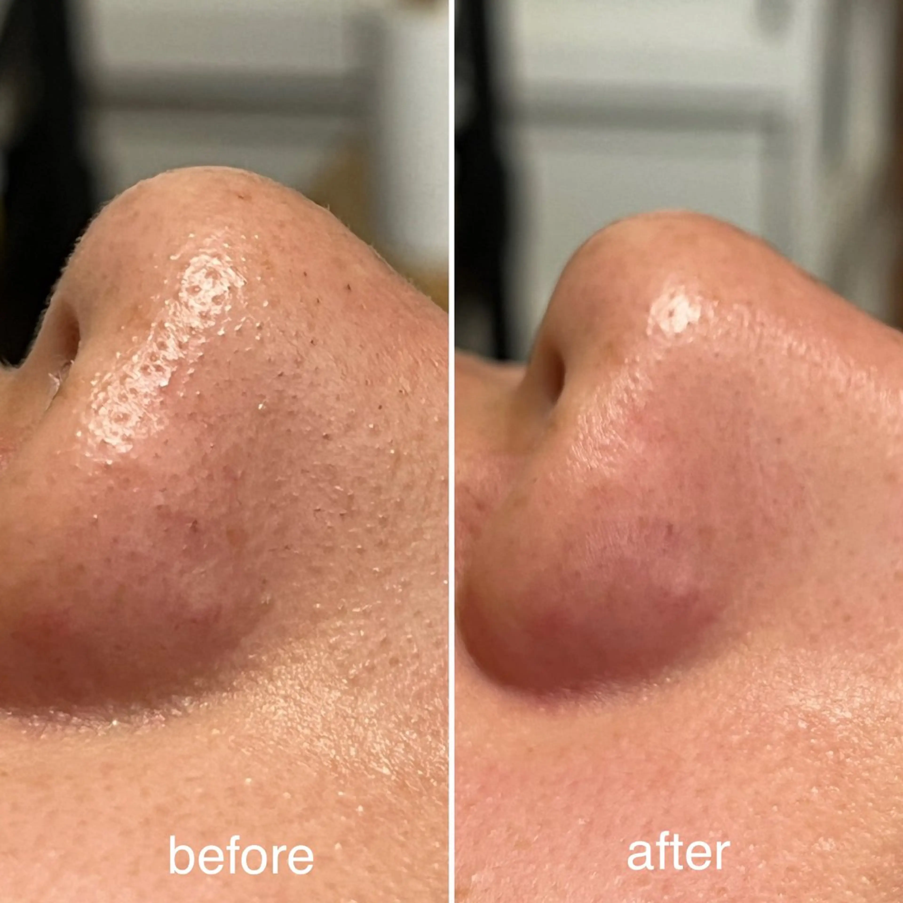 【mai*】マツヤニ ボディ/ベッドスパのエステ・リラクイメージ