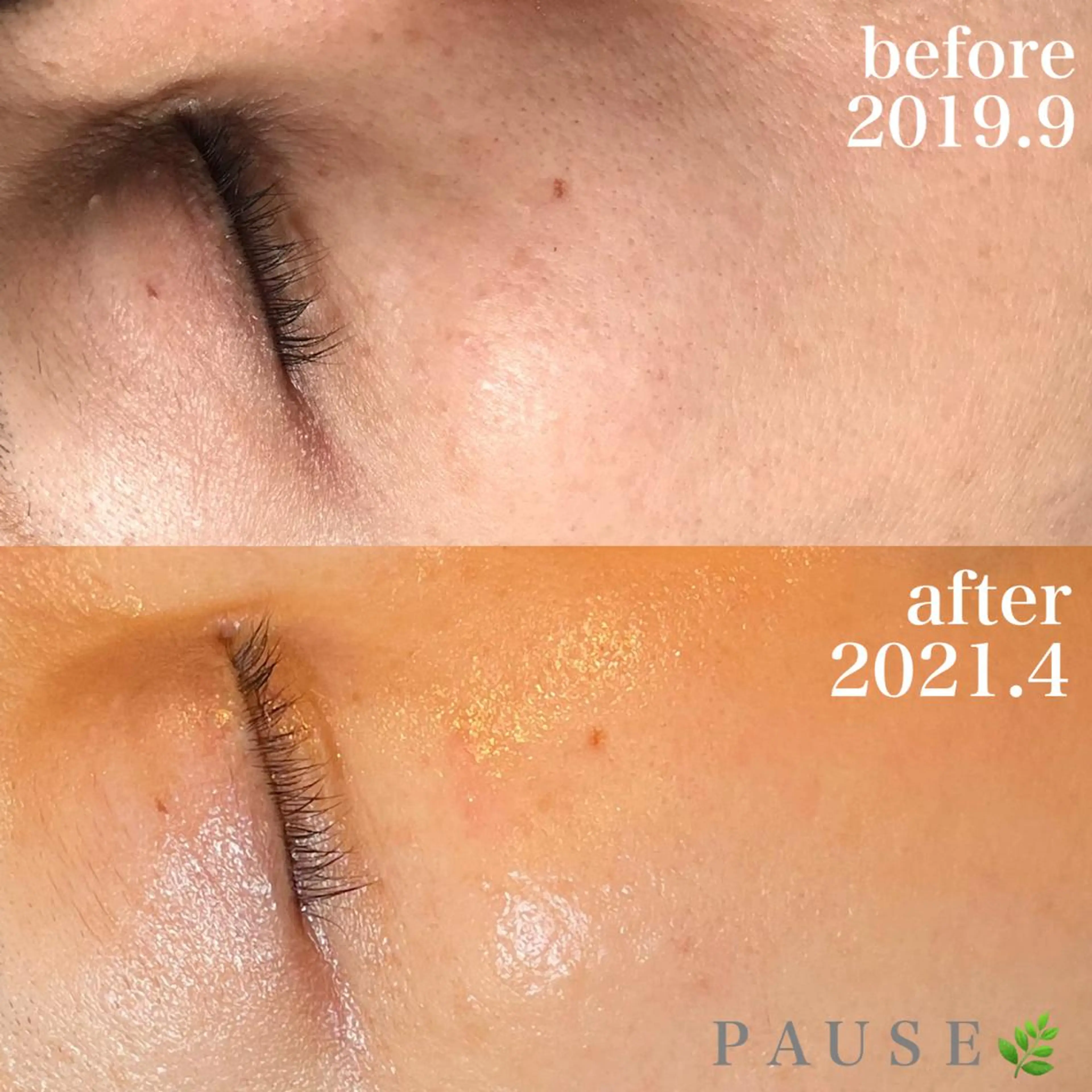 エステ 浜野 恵美のエステ・リラクイメージ