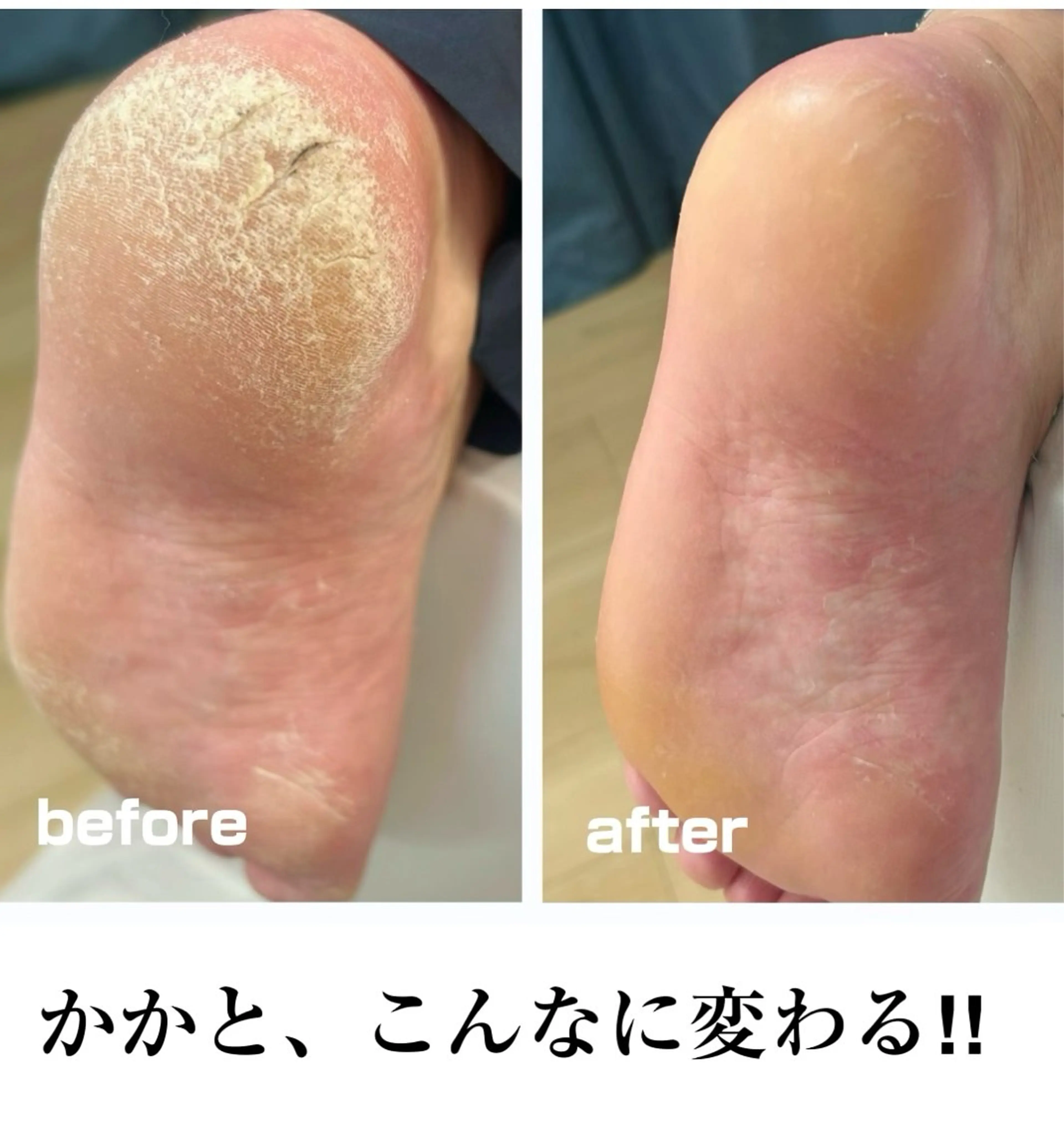 その他 フットケアサロン Kotoriのその他イメージ