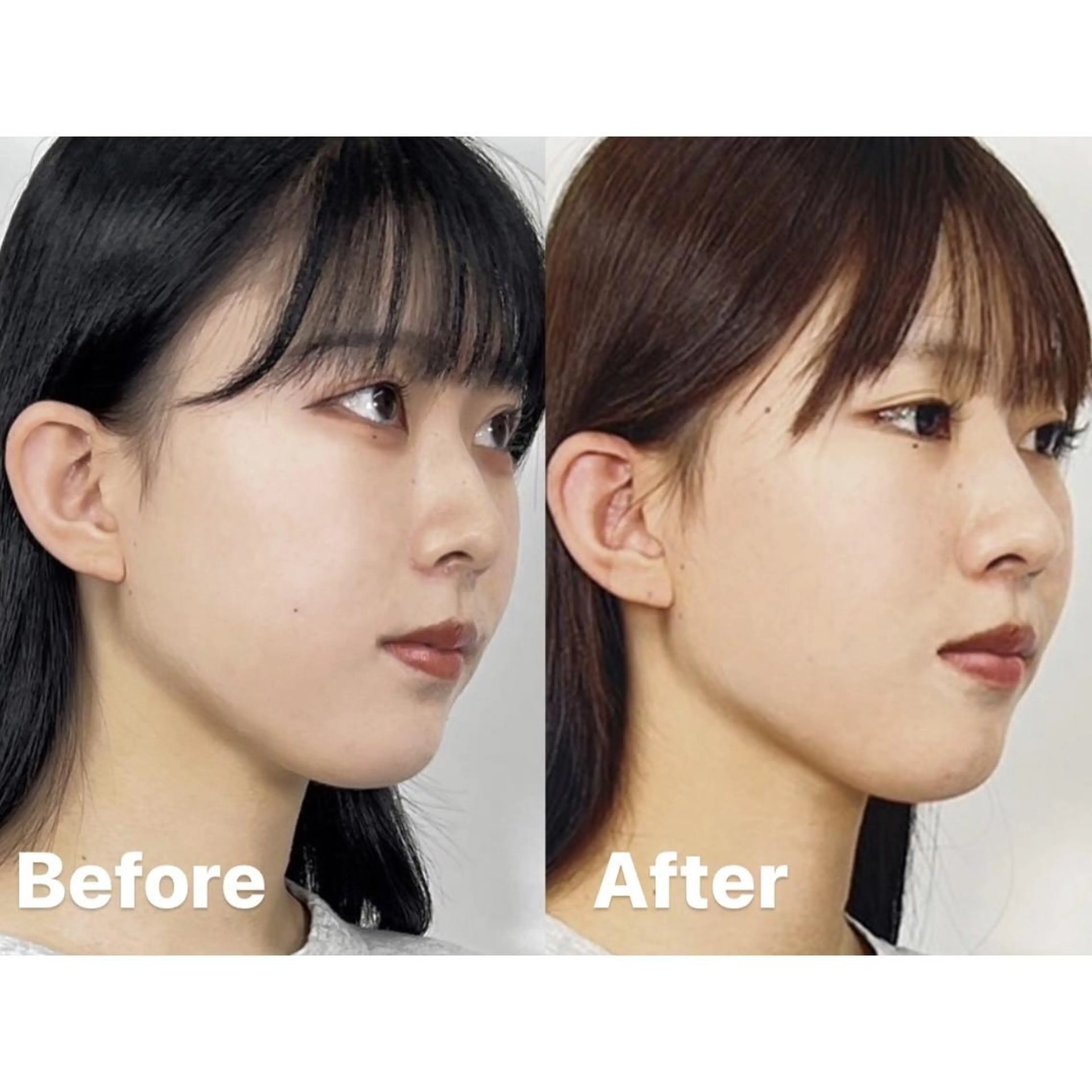 隆鼻矯正専門店ラプリ 佐藤のエステ・リラクイメージ