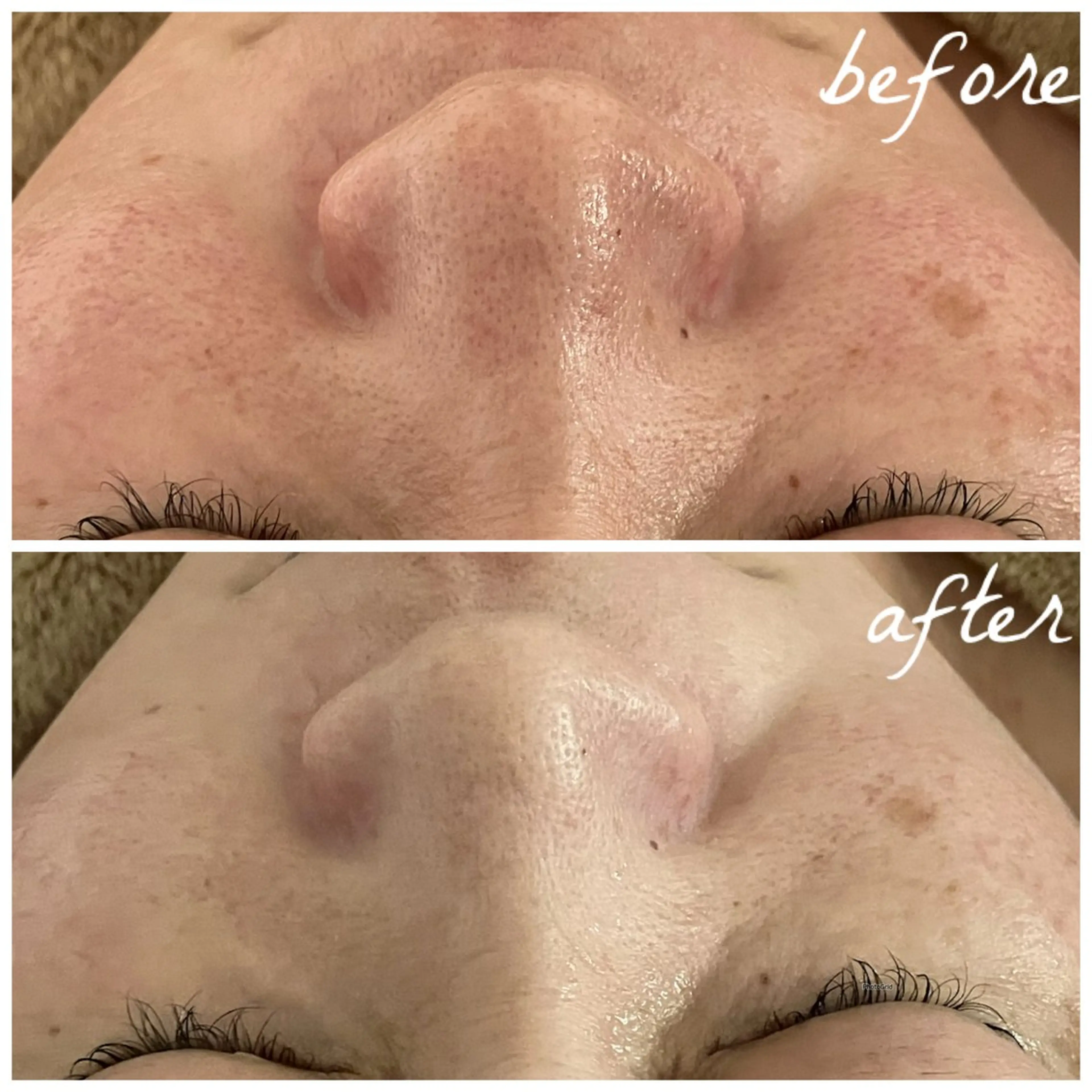 メンズ エステ メナード岐阜市茜部 杉浦のエステ・リラクイメージ