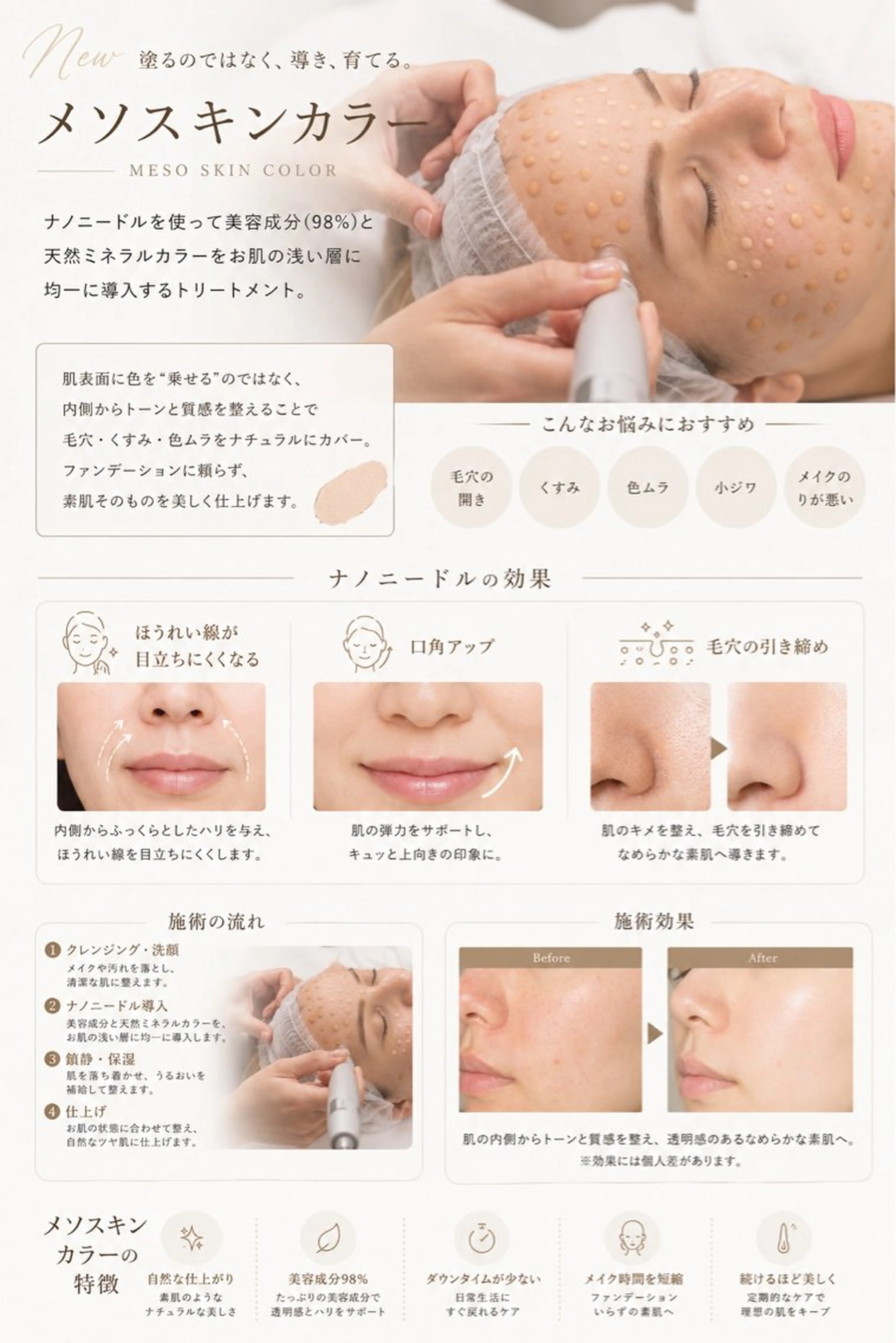 エステ リラク 肌質改善サロン réposのその他イメージ