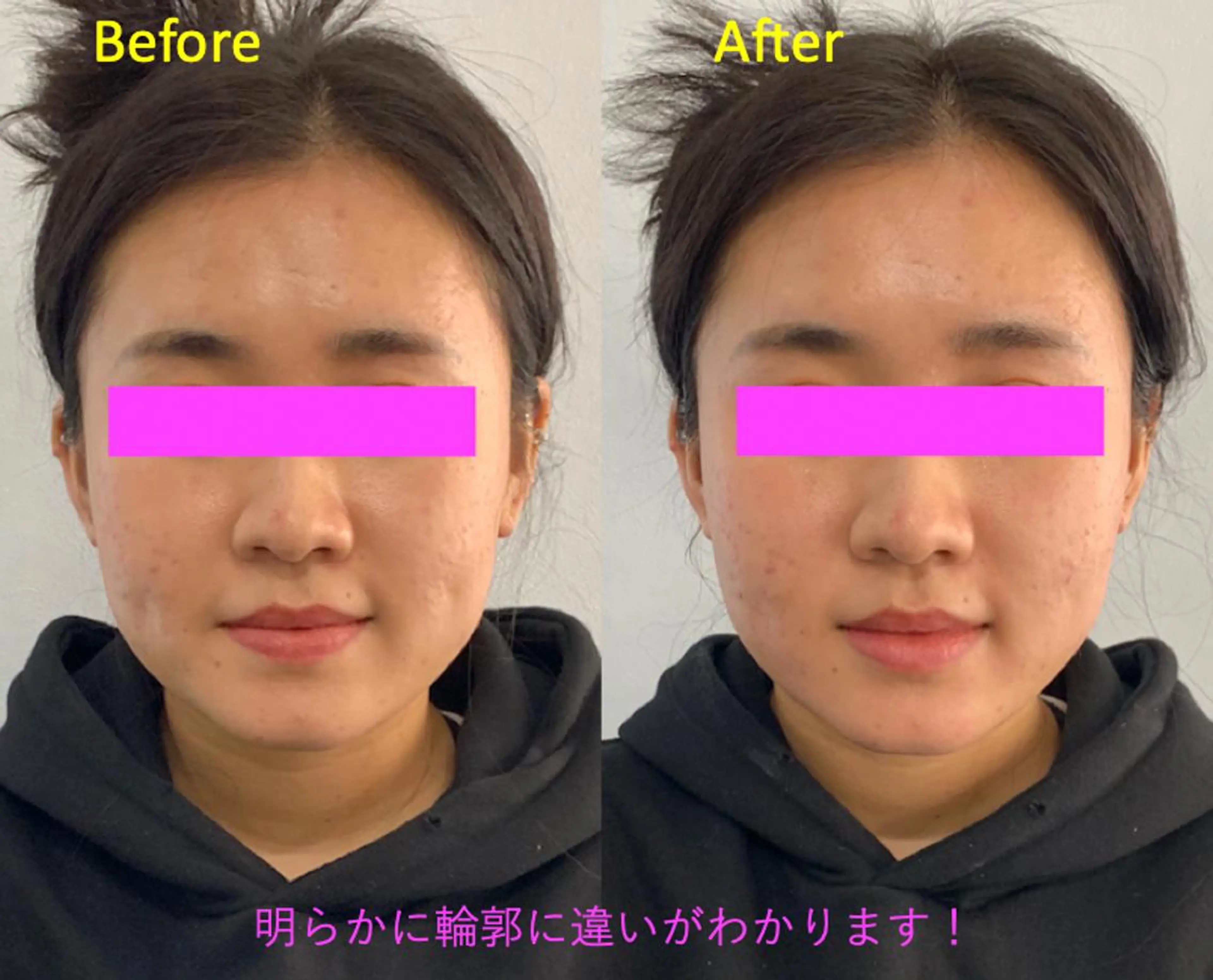 小顔美肌&痩身ｻﾛﾝ My Timeのエステ・リラクイメージ