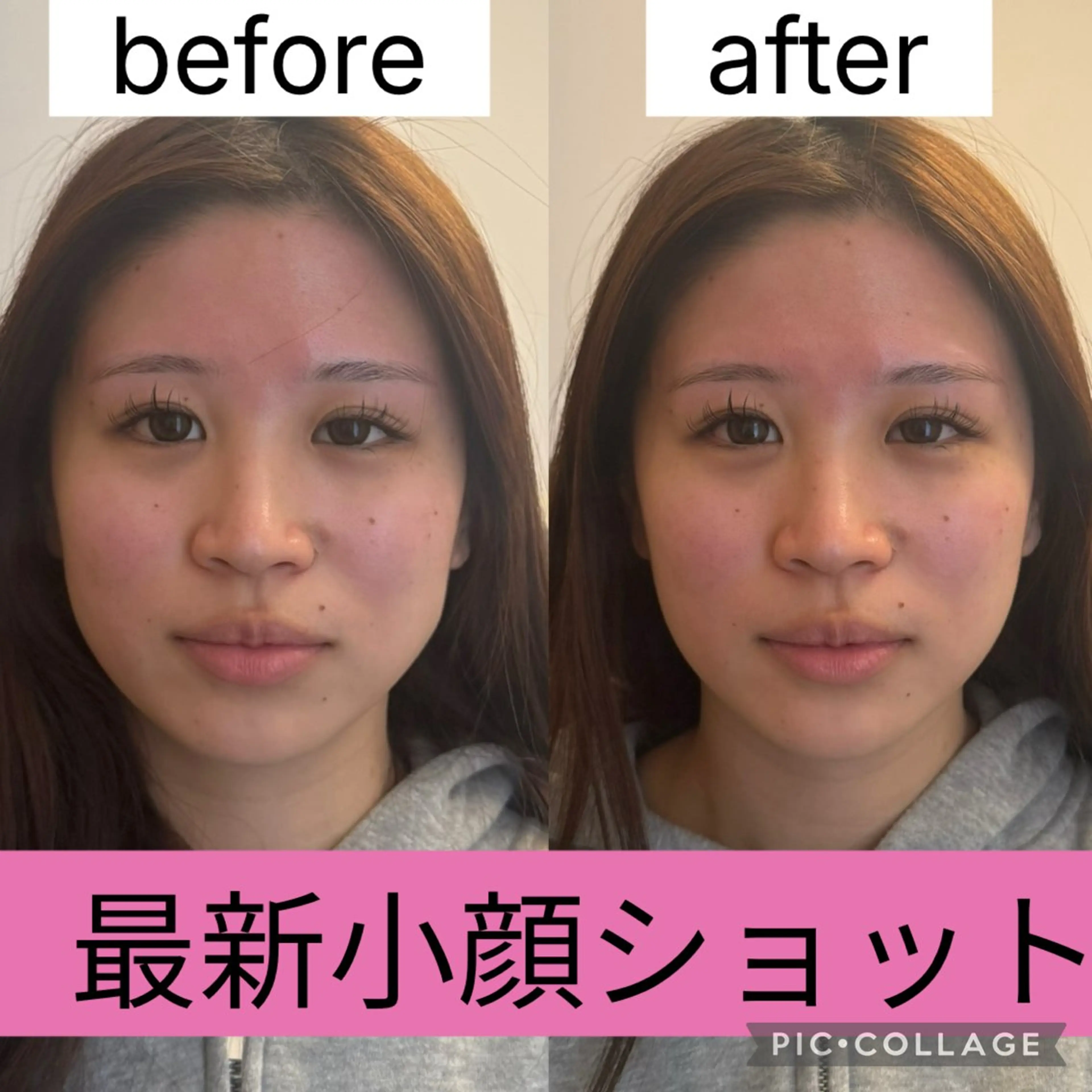 エステ 眉毛/小顔/ハーブ 🌼hikaruの眉毛・アイブロウイメージ