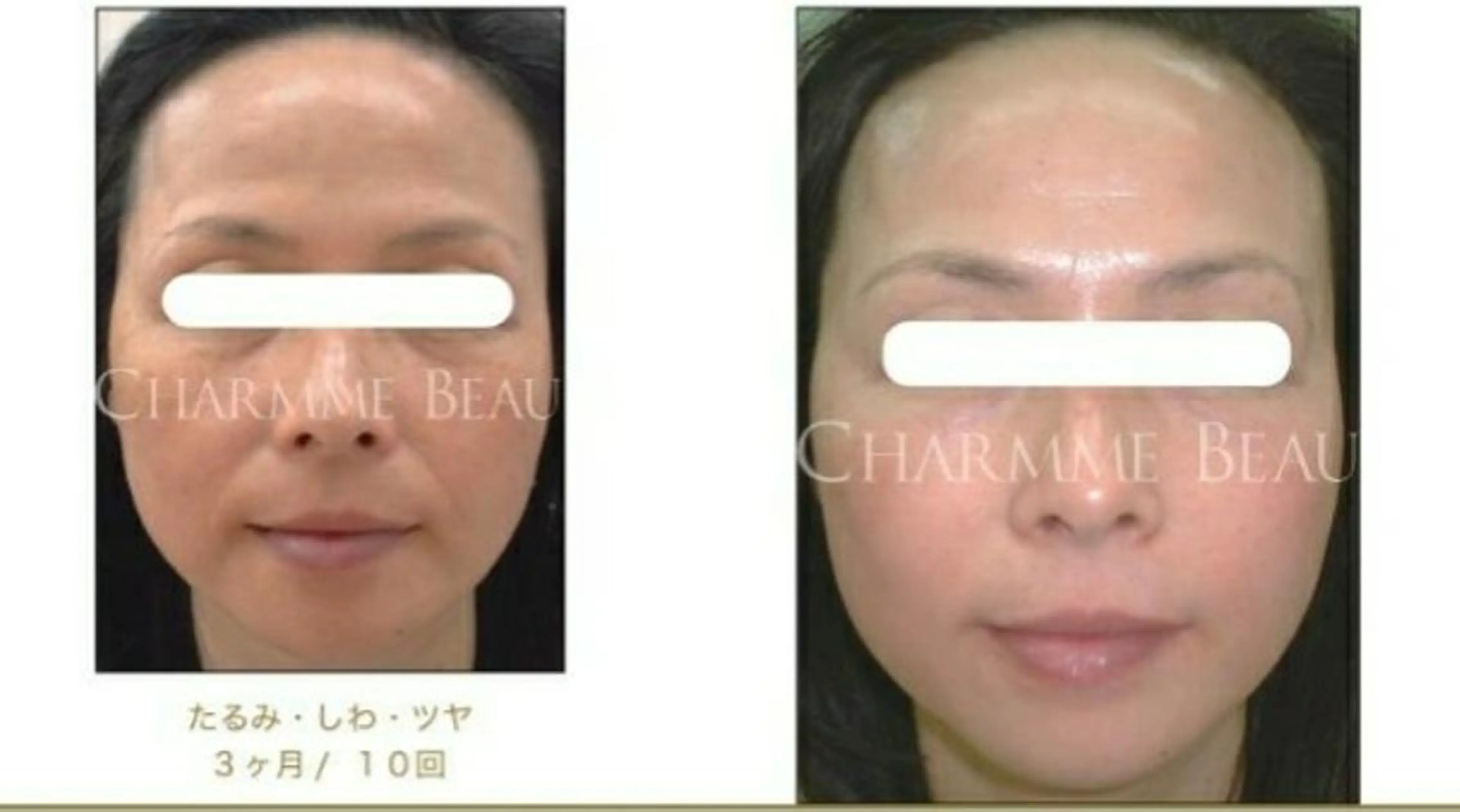 小顔と美肌 まごころエステMatoria所属・小顔 美肌専門 Matoriaのエステ・リラクイメージ