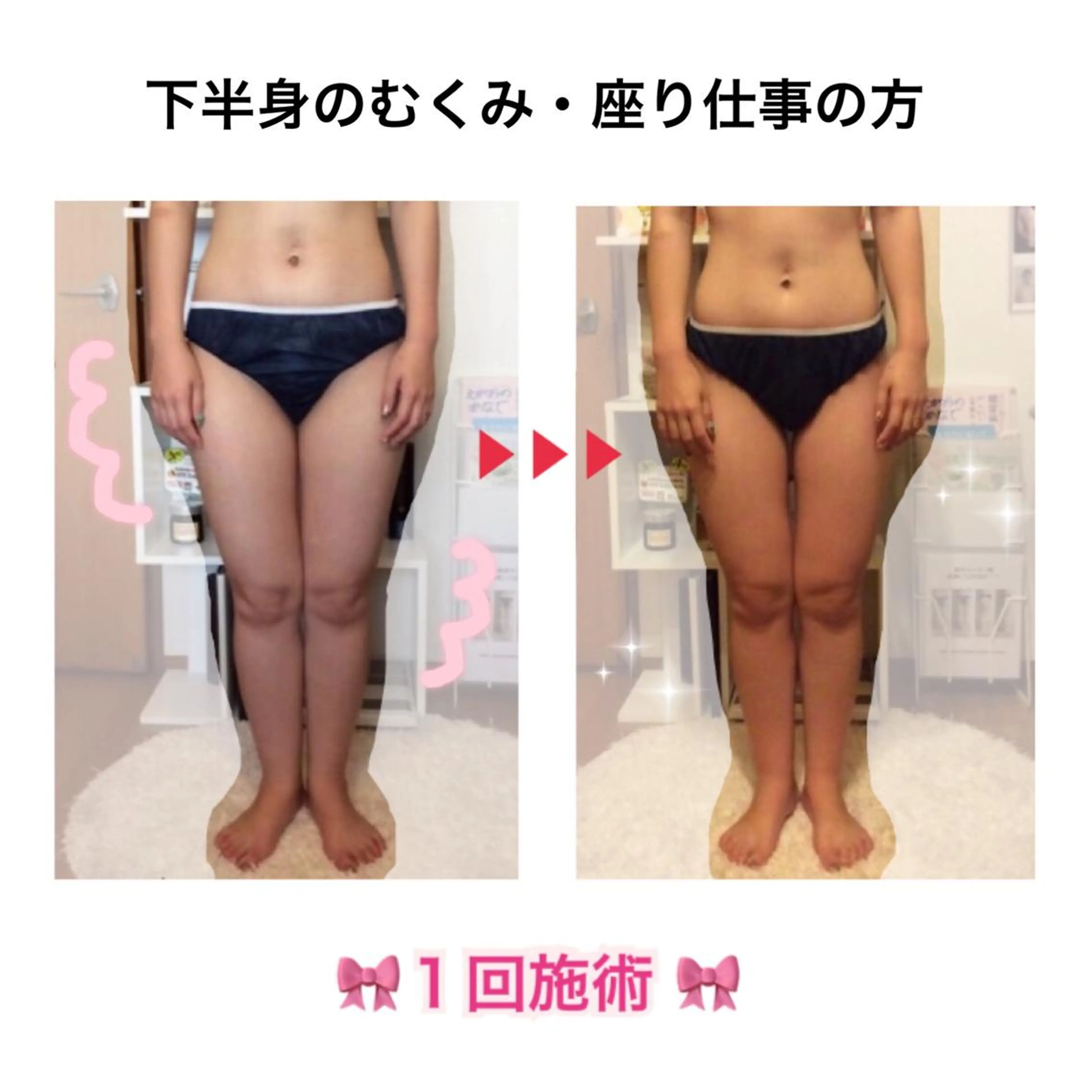 エステ リラク ダイエット・美肌ケア fleurのエステ・リラクイメージ