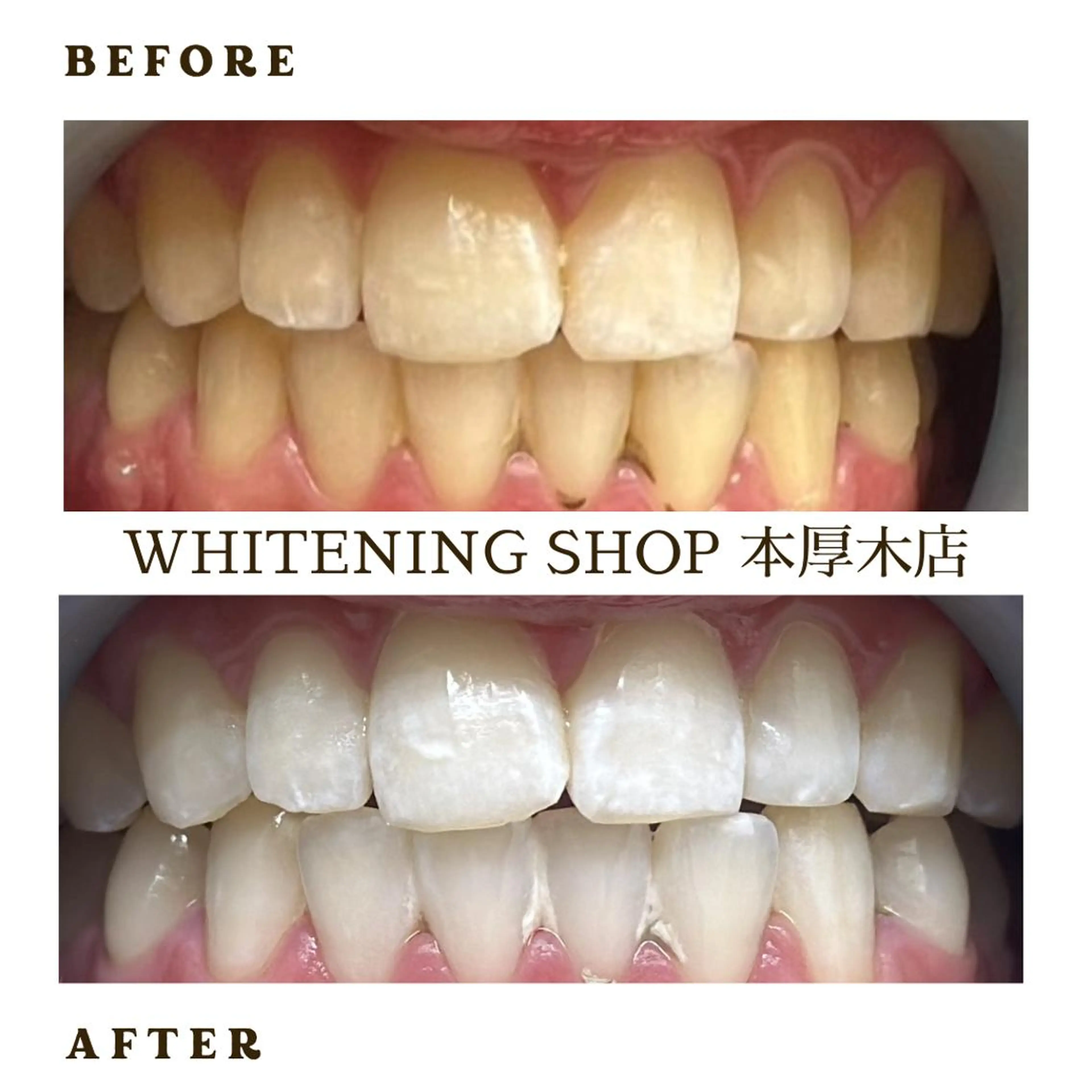メンズ その他 ホワイトニング ショップ本厚木のその他イメージ