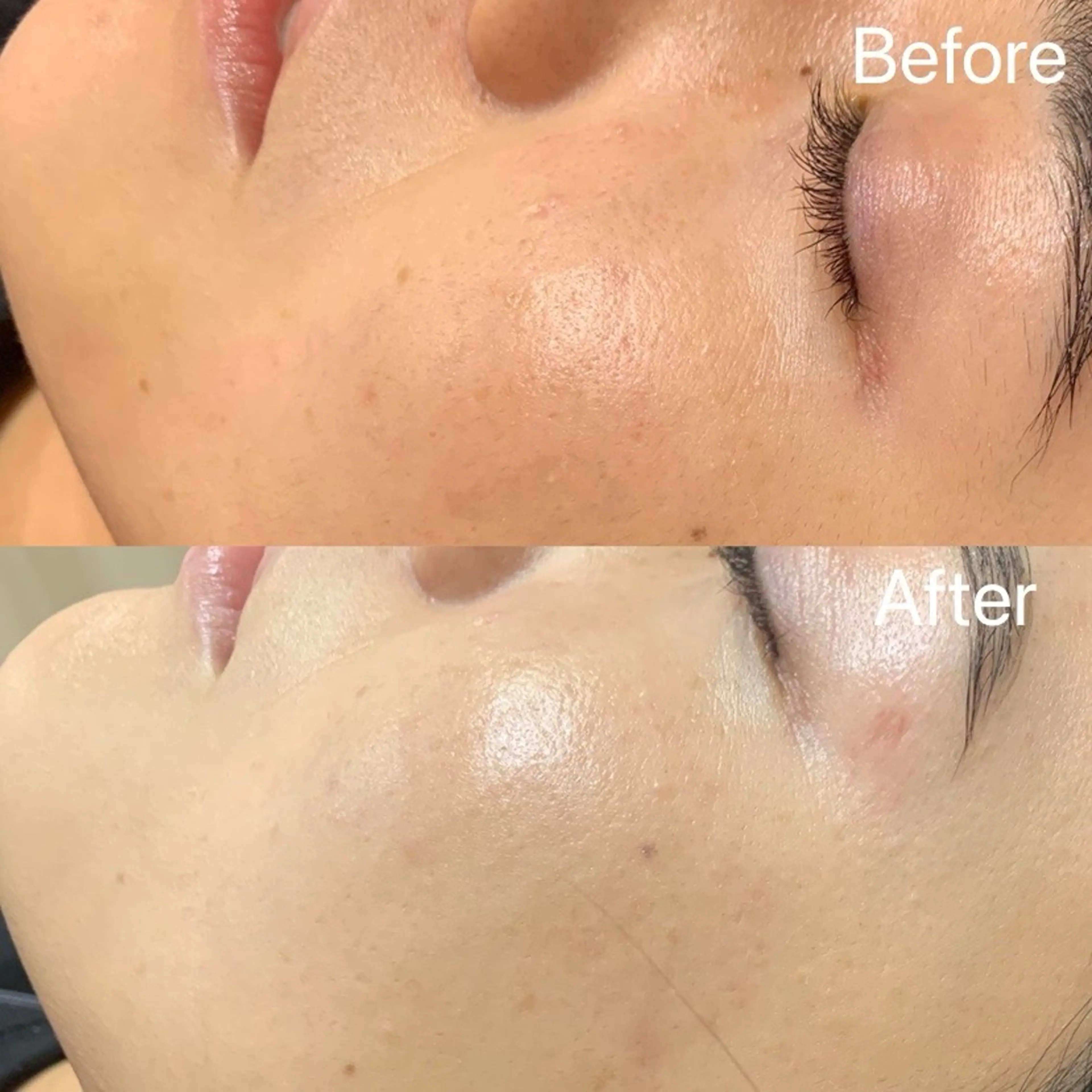 【 平日限定 !! 】 🌟フェイシャルWAX🌟の写真