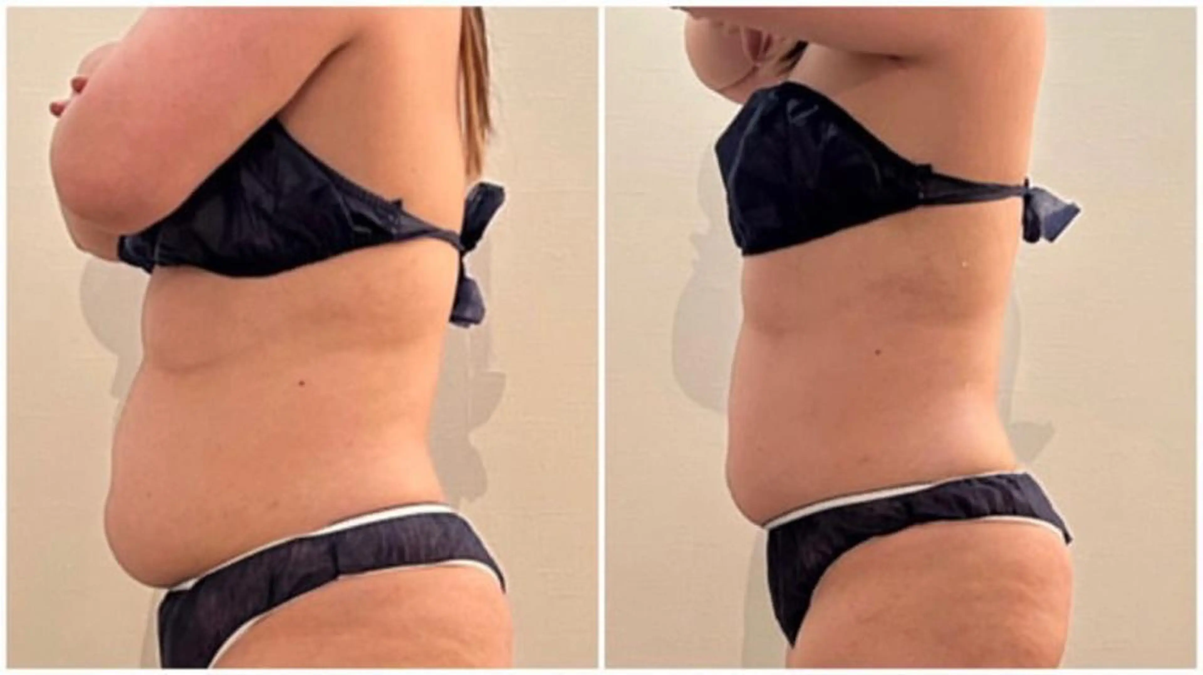 N.BODY  のエステ・リラクイメージ