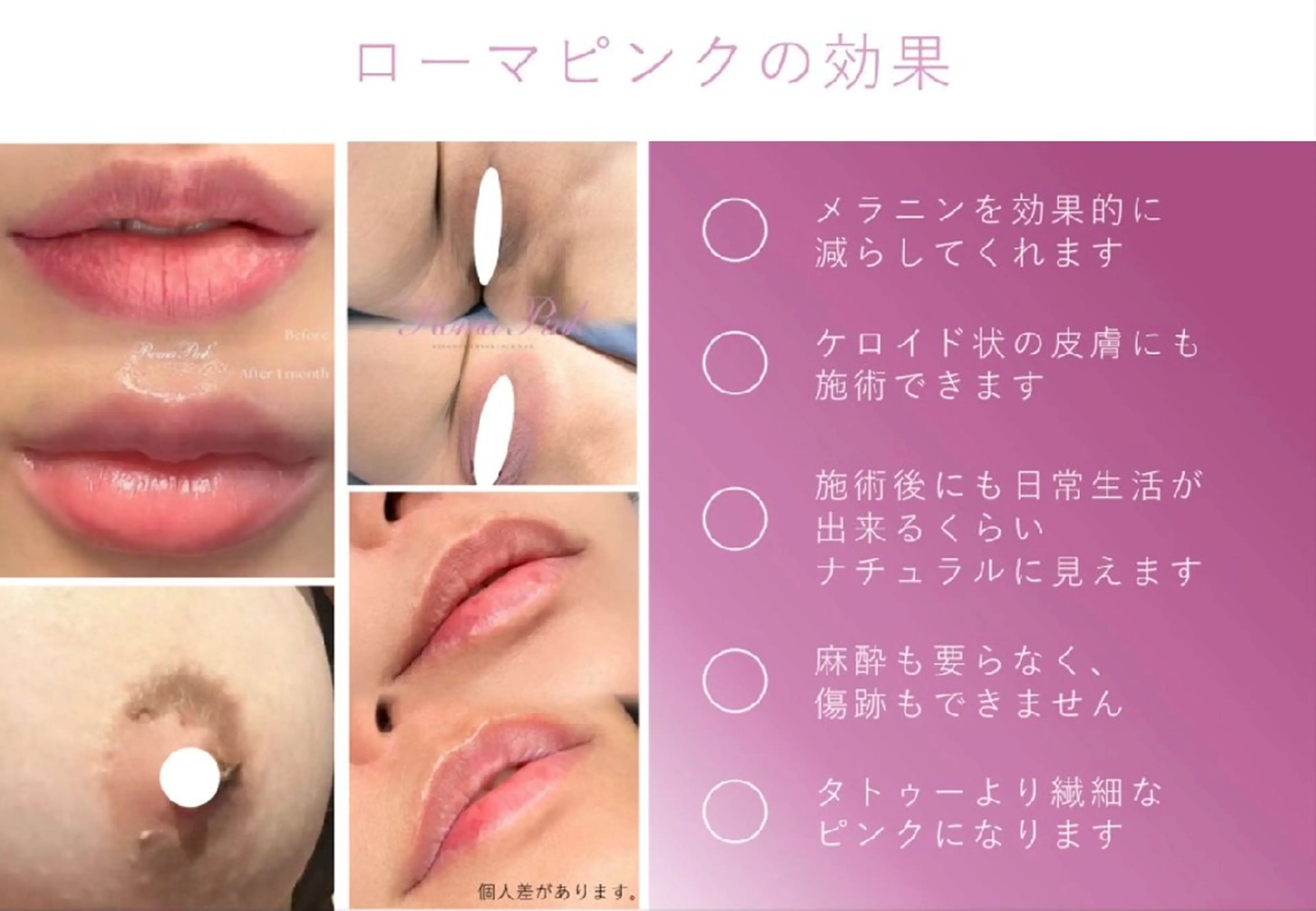 韓国最新高級美容ローマピンク👄ミニモセール限定価格の写真