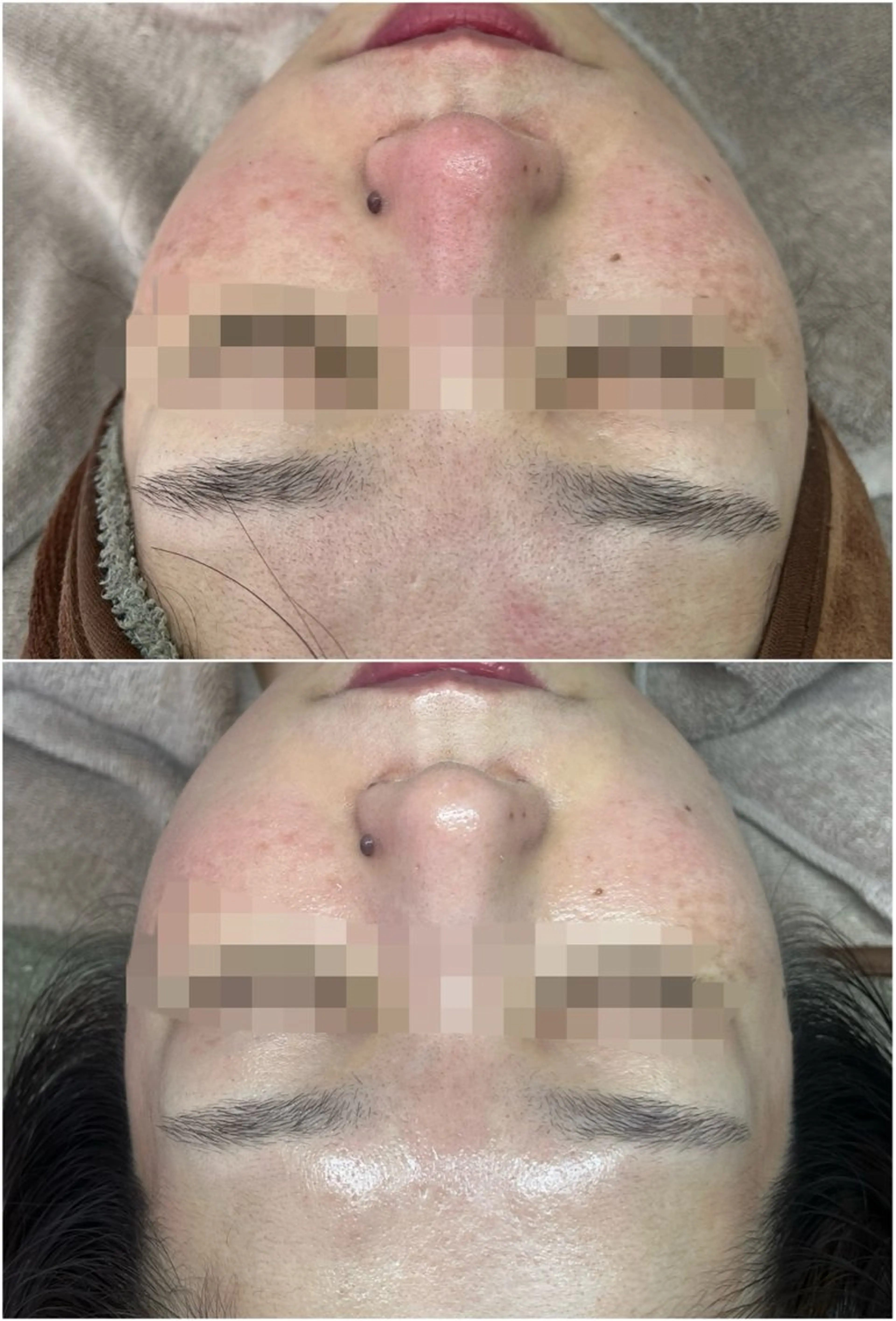 cherir所属・cherir大井町/ 毛穴ニキビ改善専門のエステ・リラクイメージ