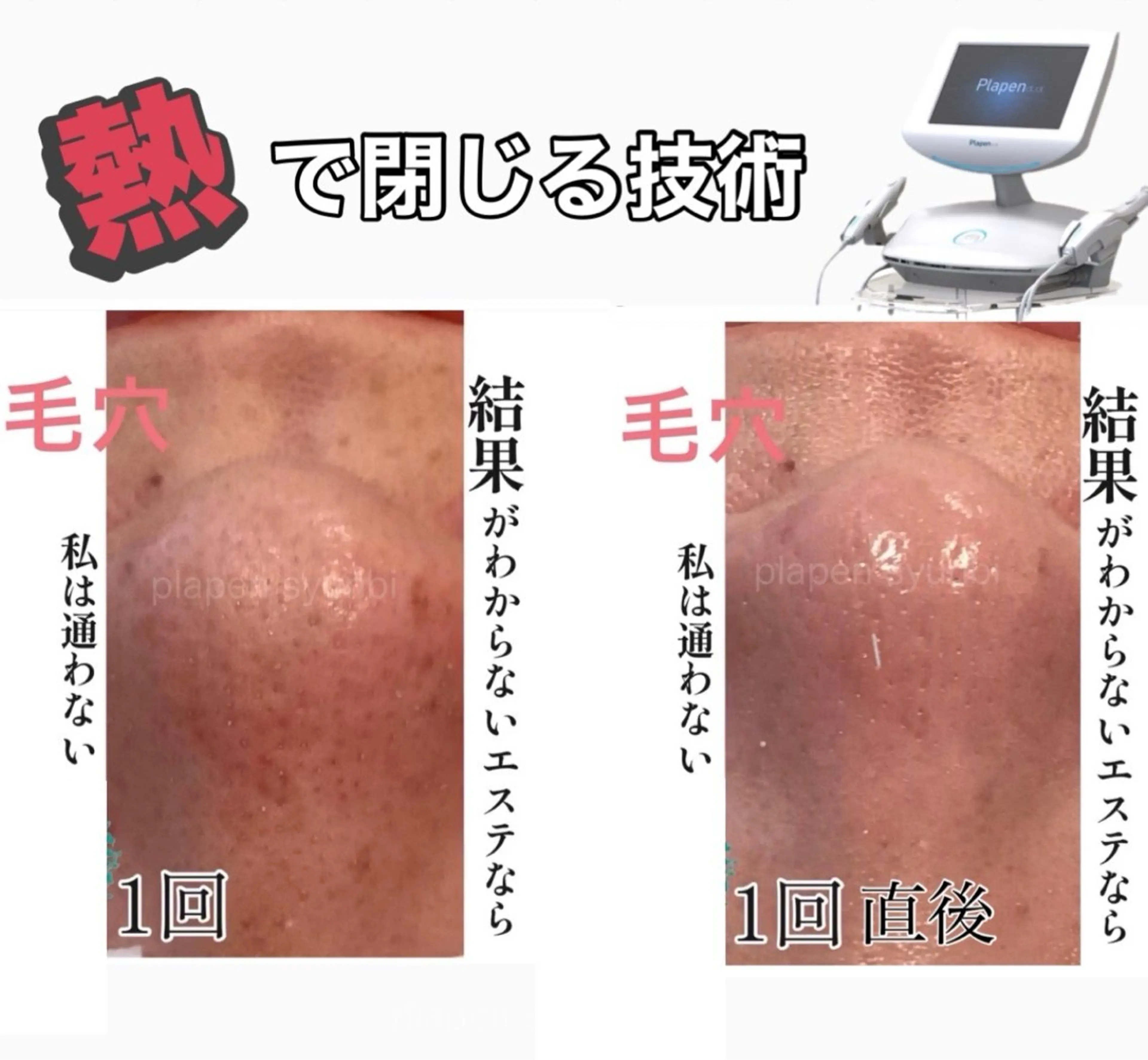 エステ Lumiere despoirのエステ・リラクイメージ