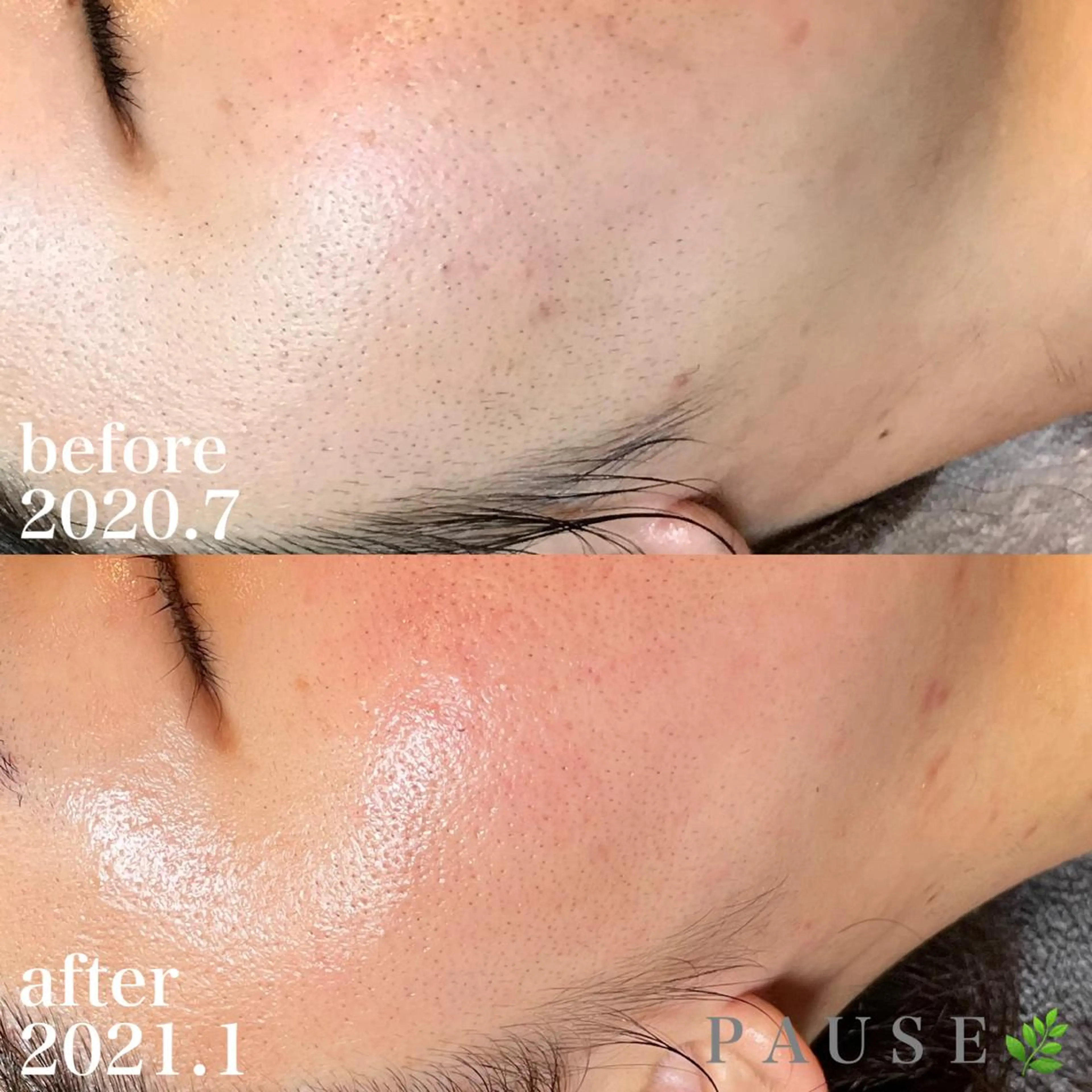 エステ 浜野 恵美のエステ・リラクイメージ