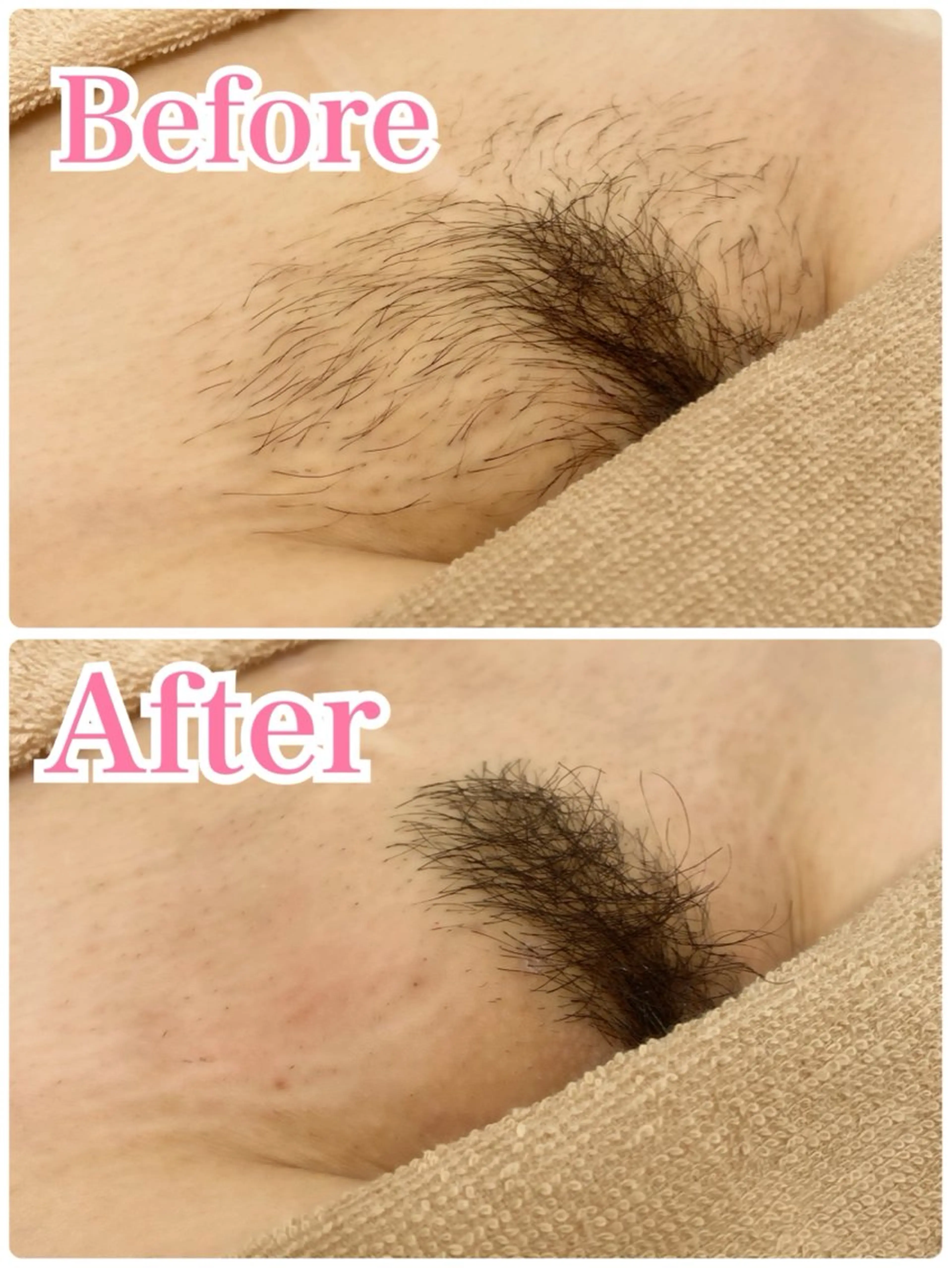 カラー シュガーリング脱毛 専門店Ranunのエステ・リラクイメージ