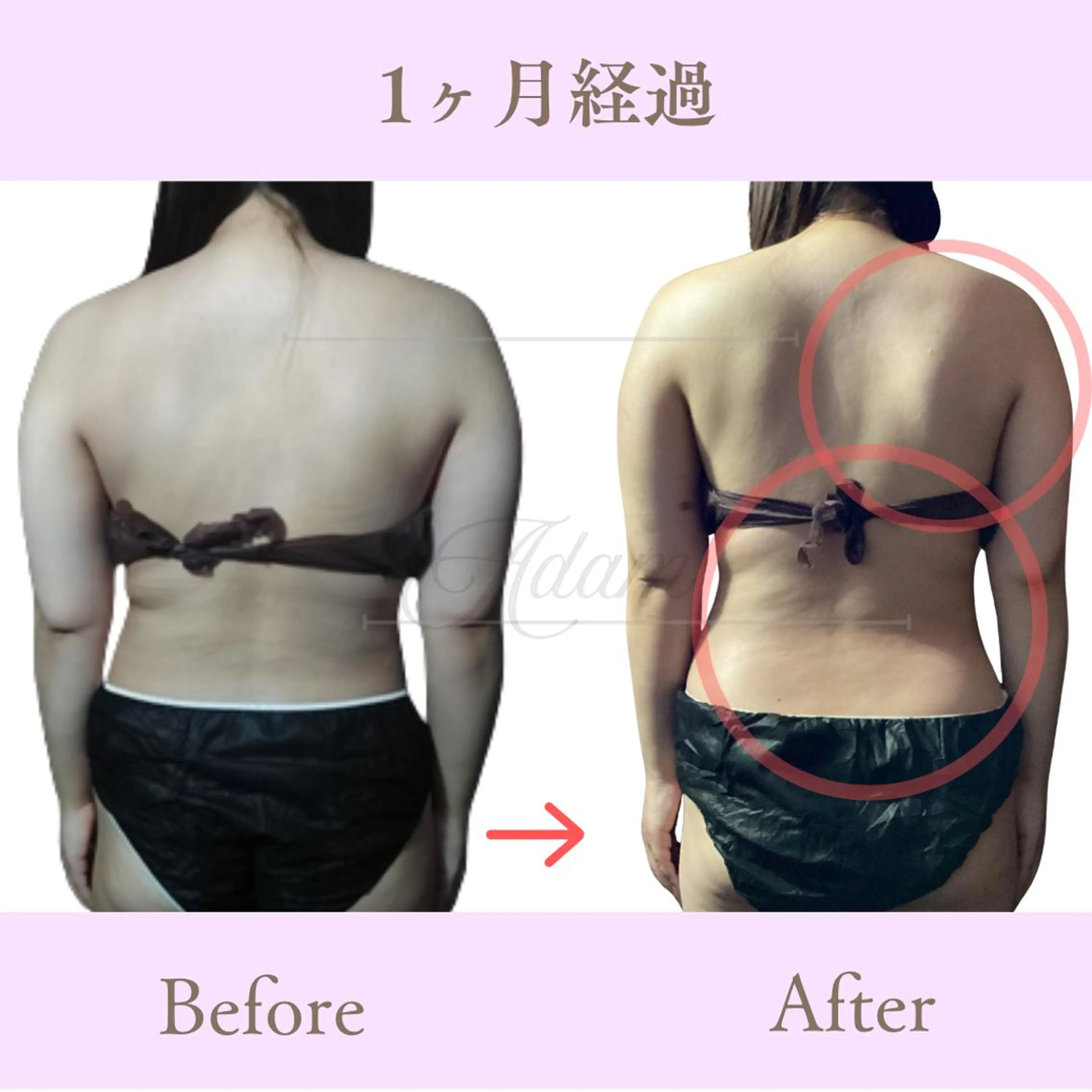 Adam 上半身美人のエステ・リラクイメージ