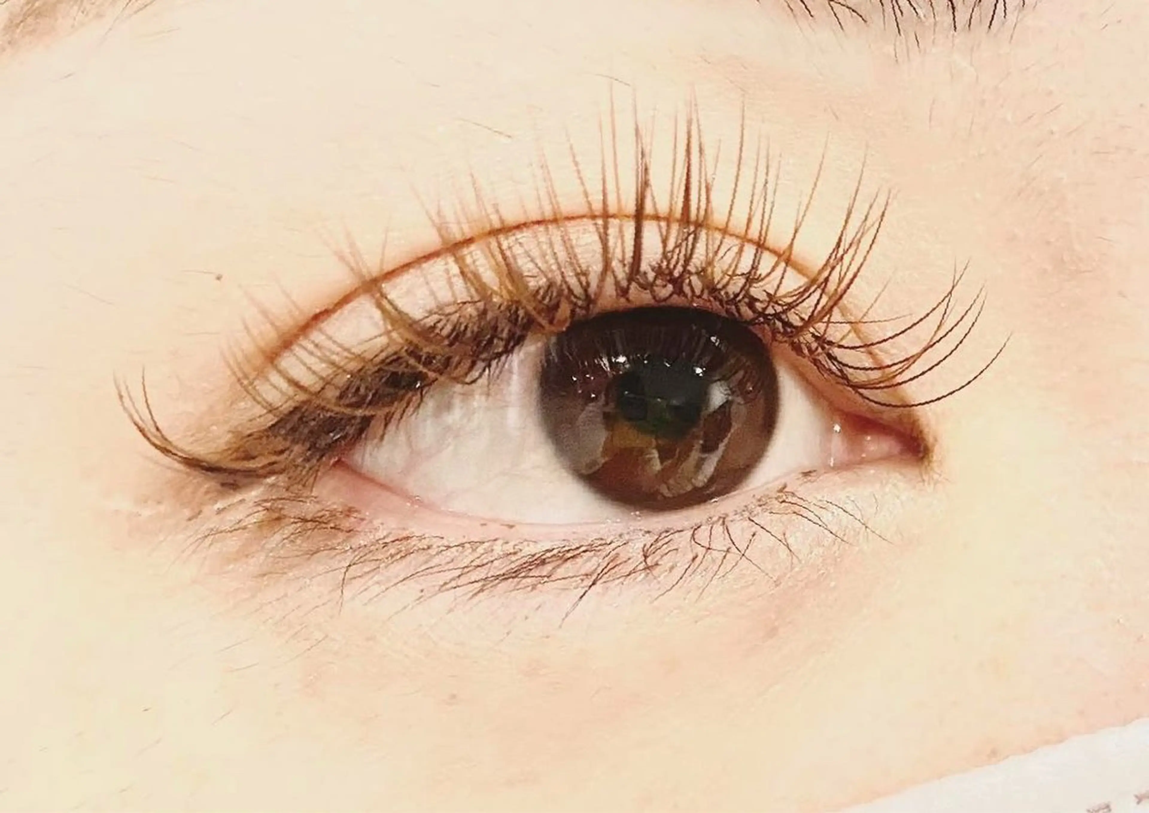 シングルラッシュ100本の写真