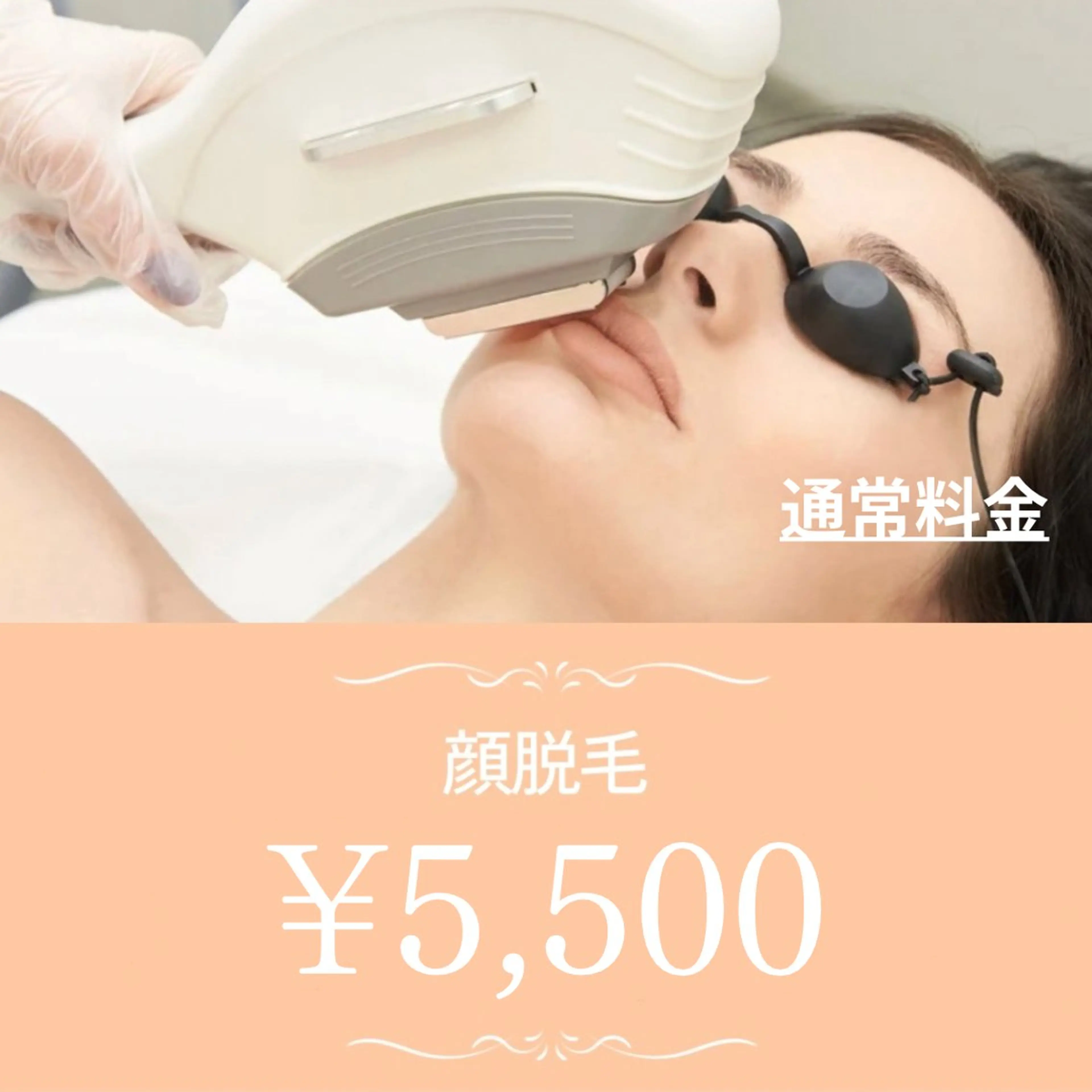 【リピーター様🙂↕️✨】化粧ノリ◎美白◎ムダ毛排除で美白肌♪顔脱毛 ¥5,500の写真