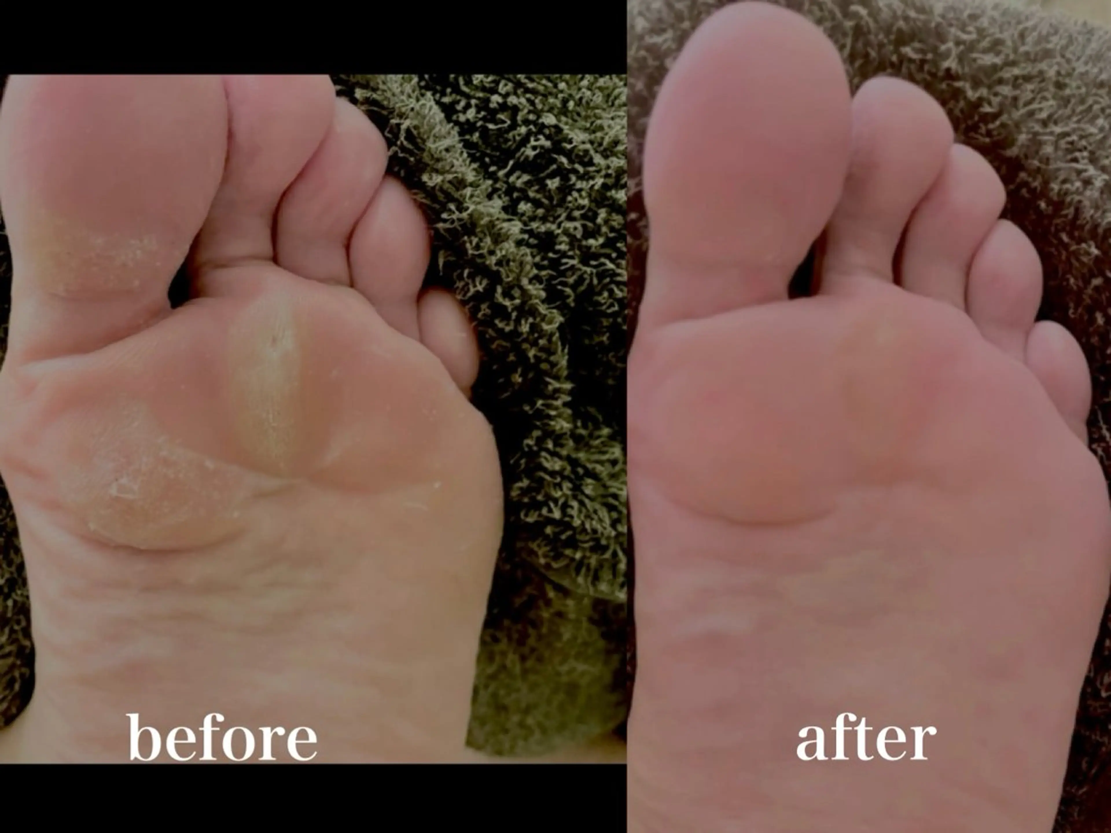 Spiky とうげ ふうかのネイルデザイン