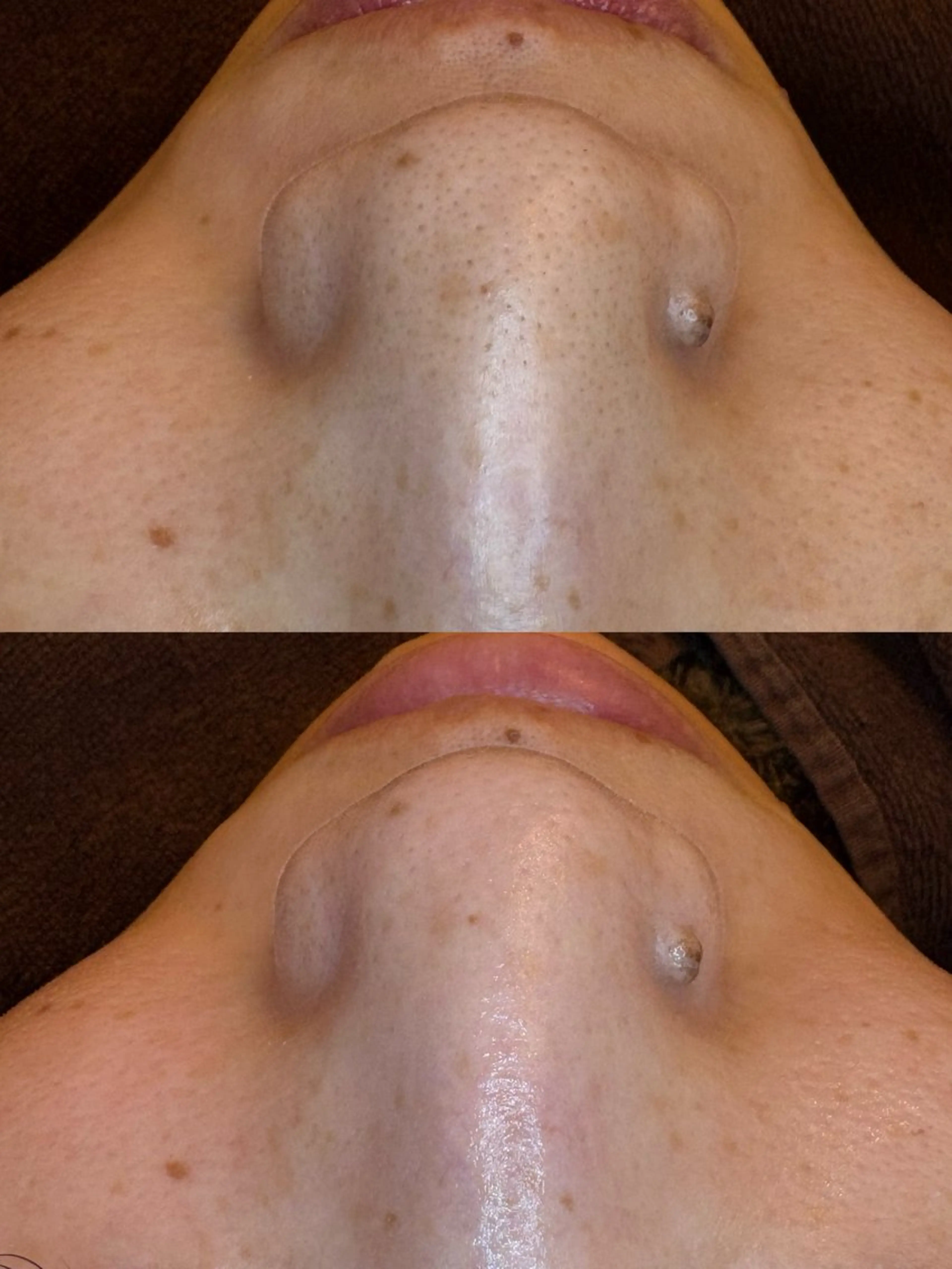 🤍アベシュリ /フェイシャル🤍のエステ・リラクイメージ