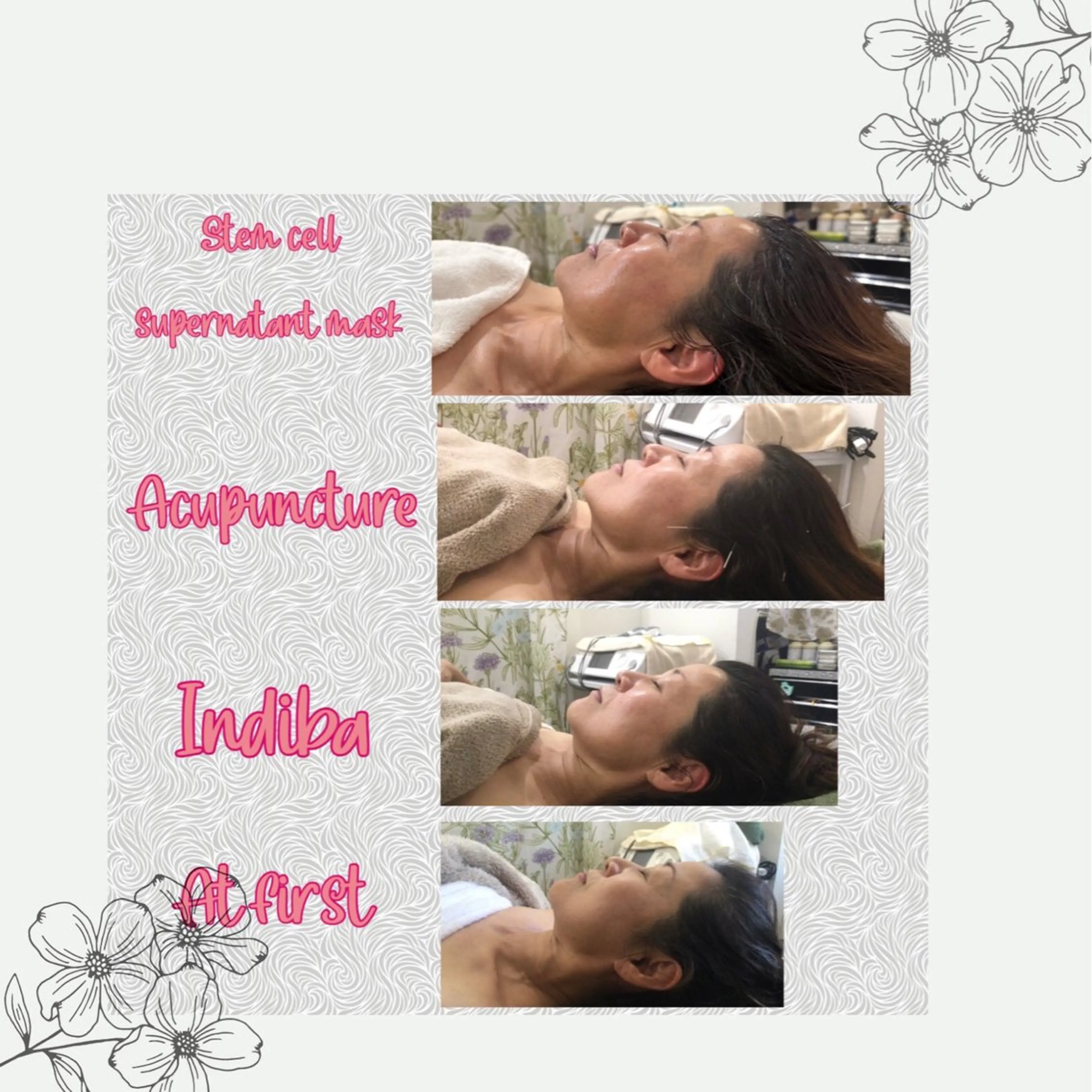 美容鍼&温活・免活 さくらんぼ鍼灸院のエステ・リラクイメージ