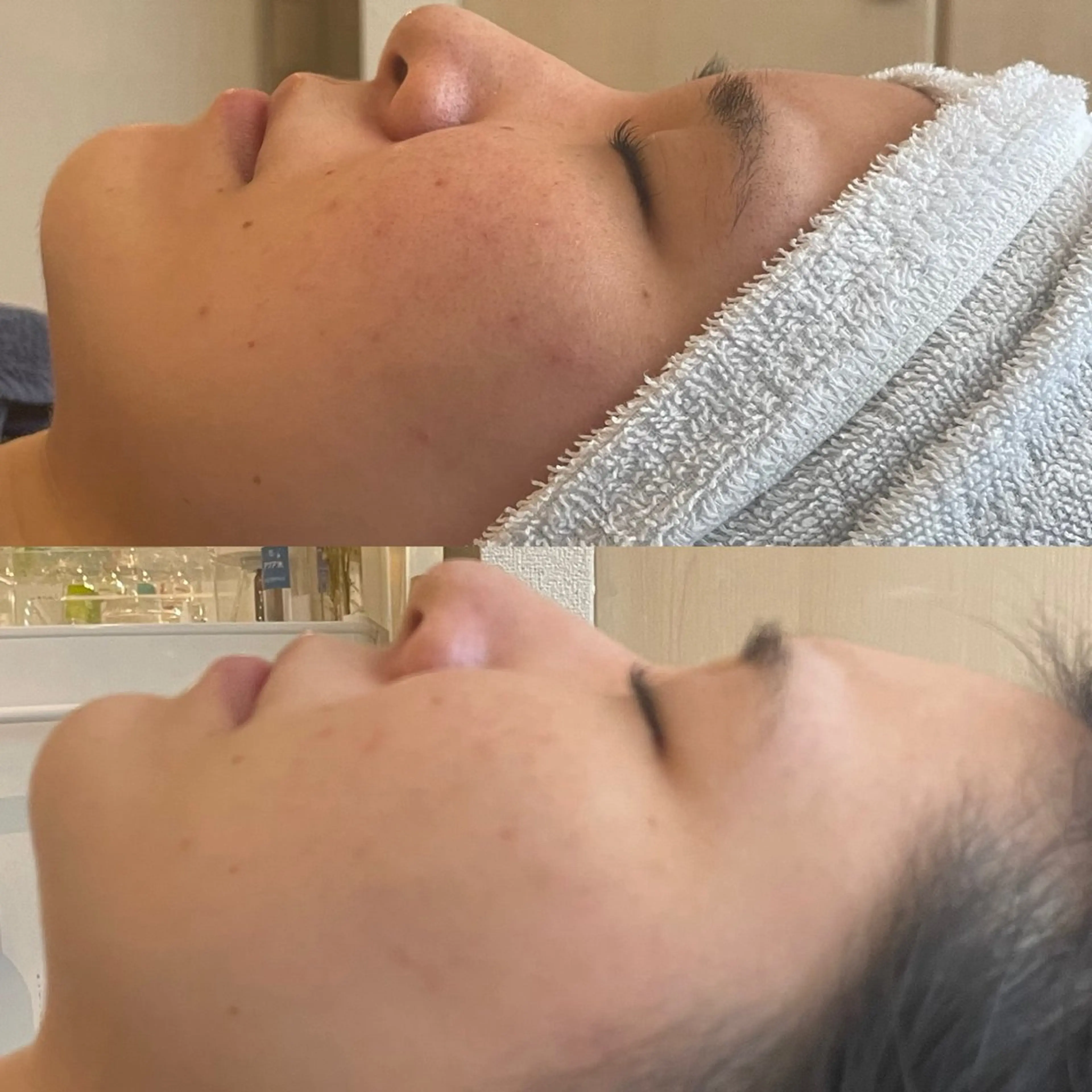 エステ 素肌キレイLab.所属・≪ニキビケア≫ 素肌キレイLab.のエステ・リラクイメージ