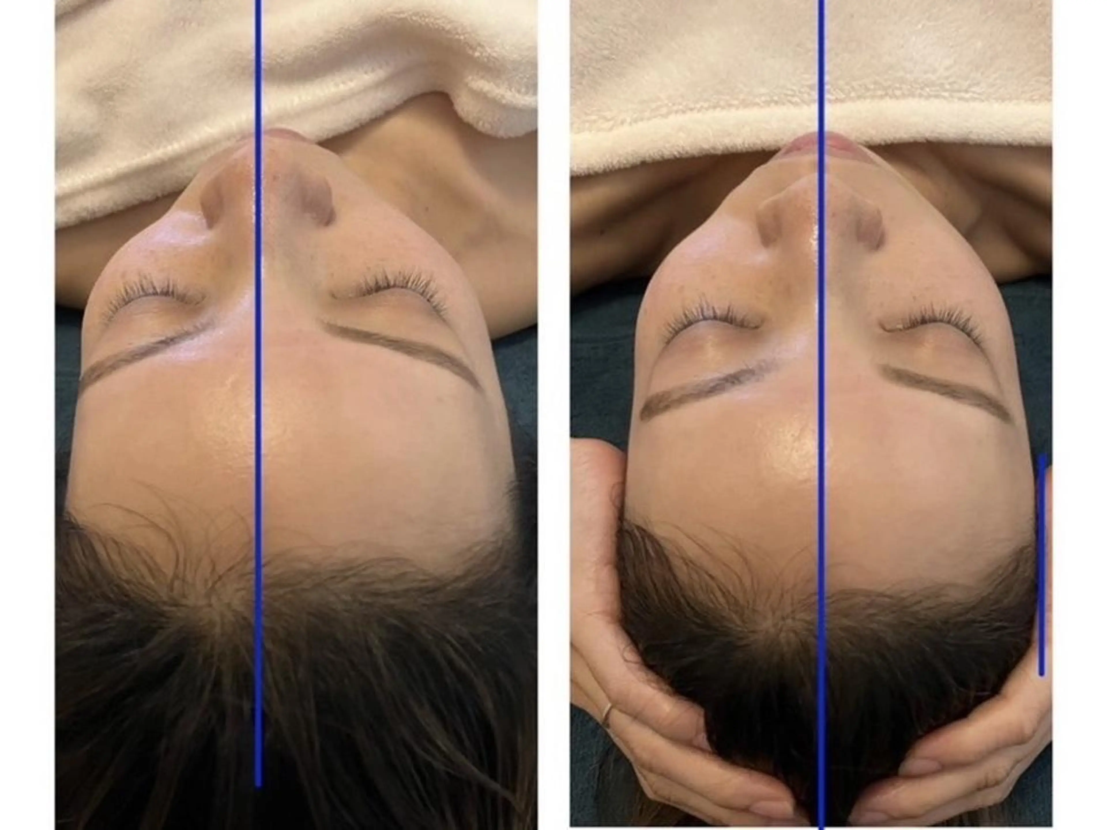 LUANA 美肌脱毛＋Skinのエステ・リラクイメージ