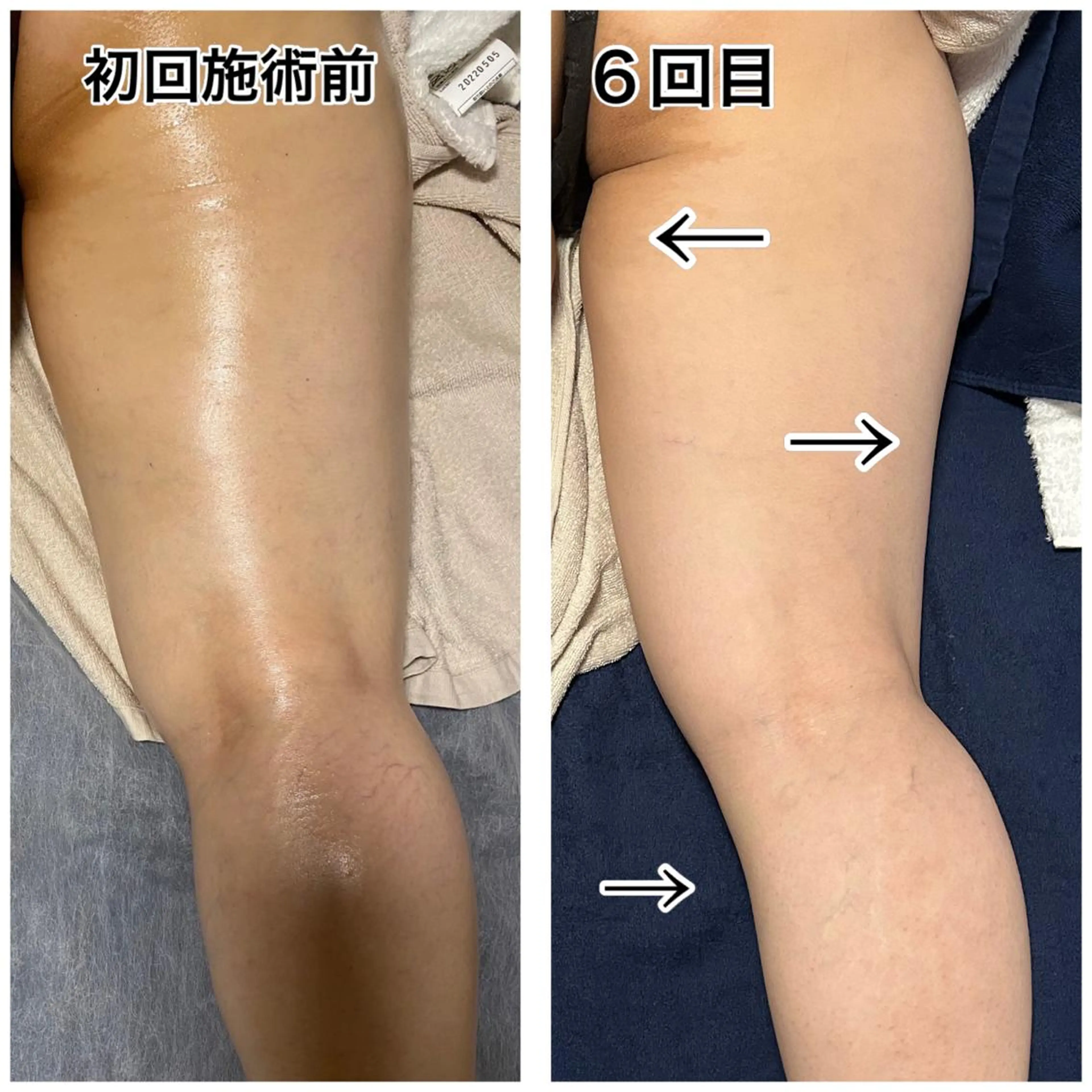 🌴Beauty Salon LANAのエステ・リラクイメージ