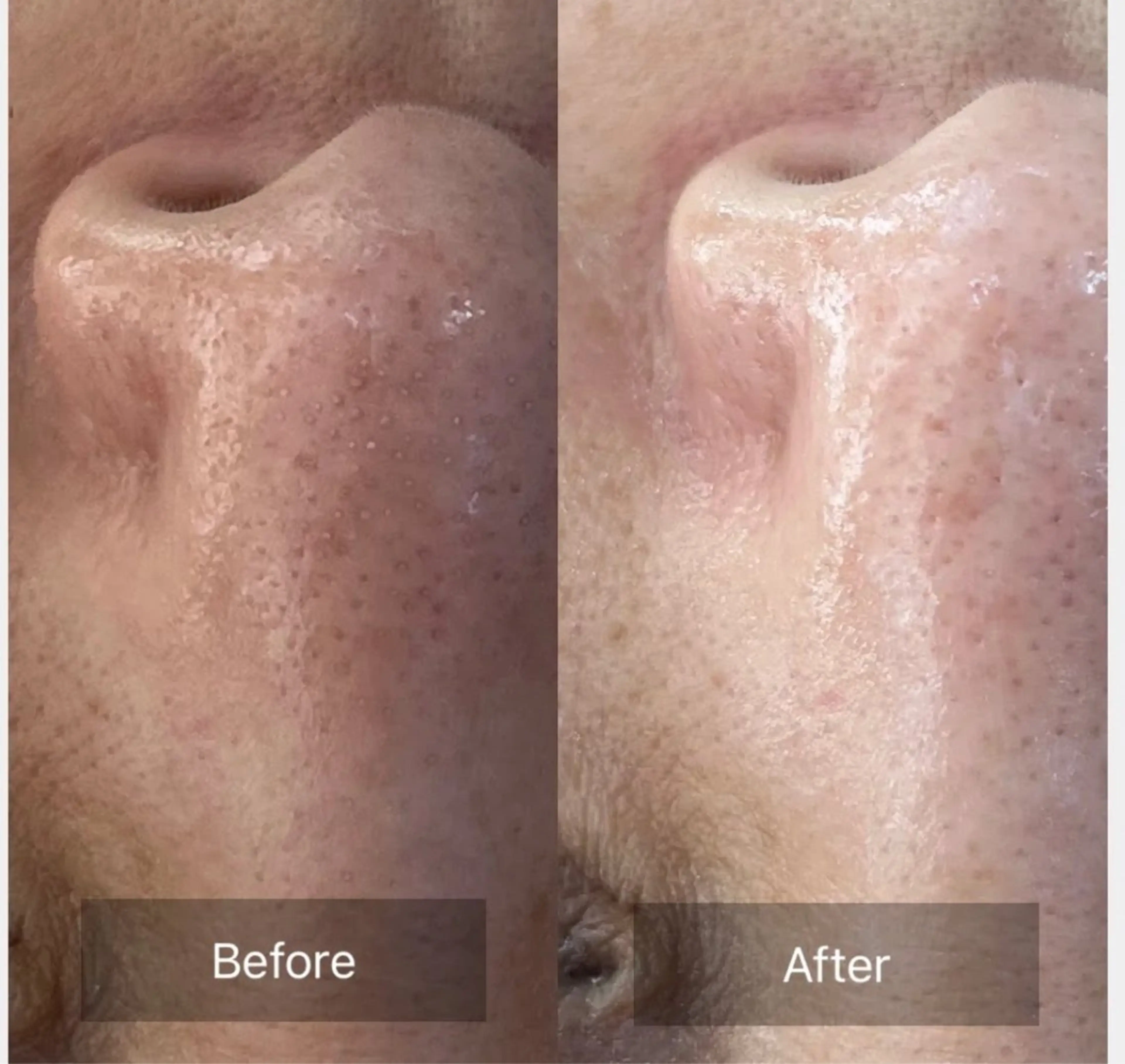 毛穴洗浄パック付きの写真