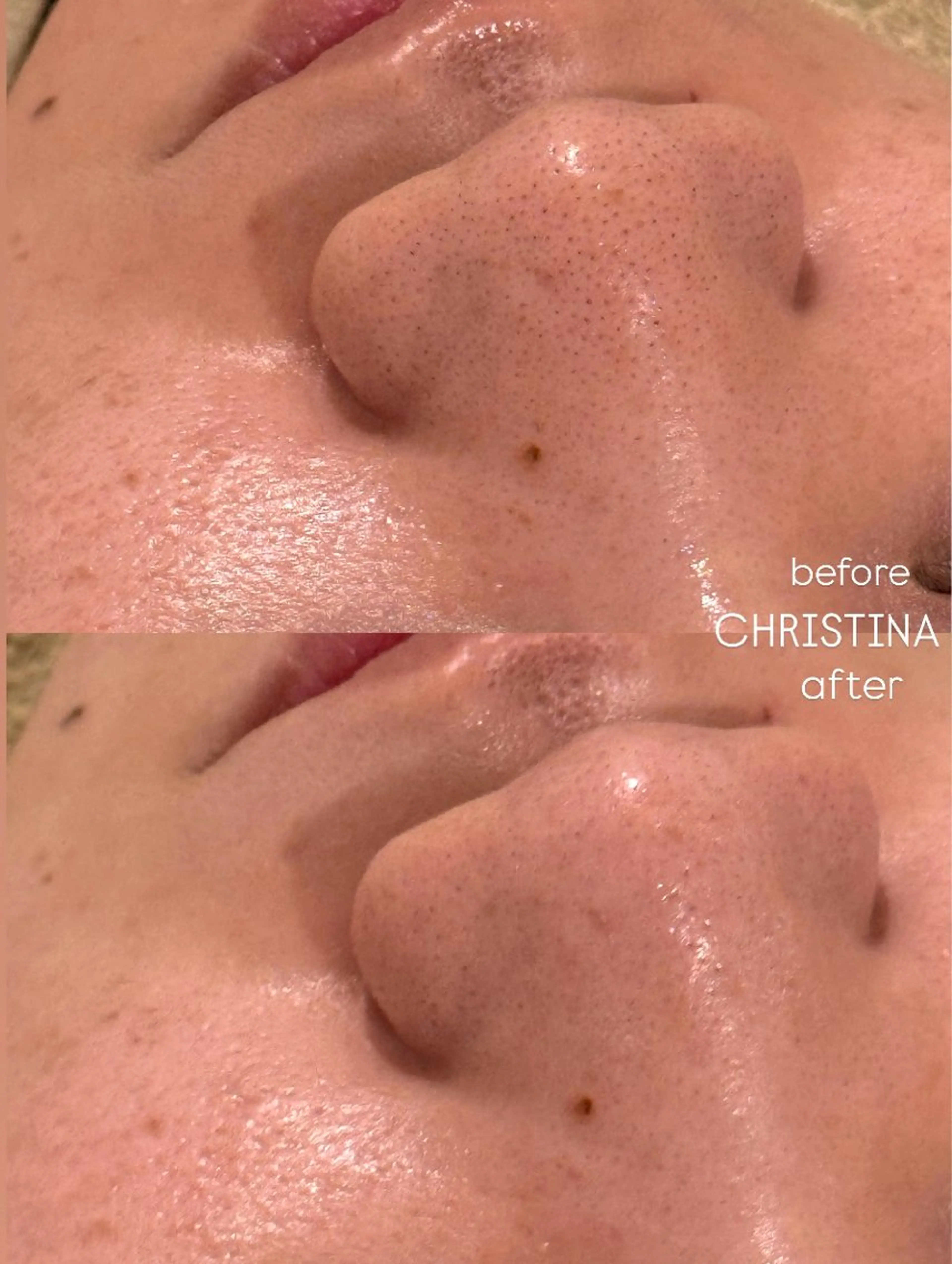 エステ Ele所属・有田 佑佳のエステ・リラクイメージ