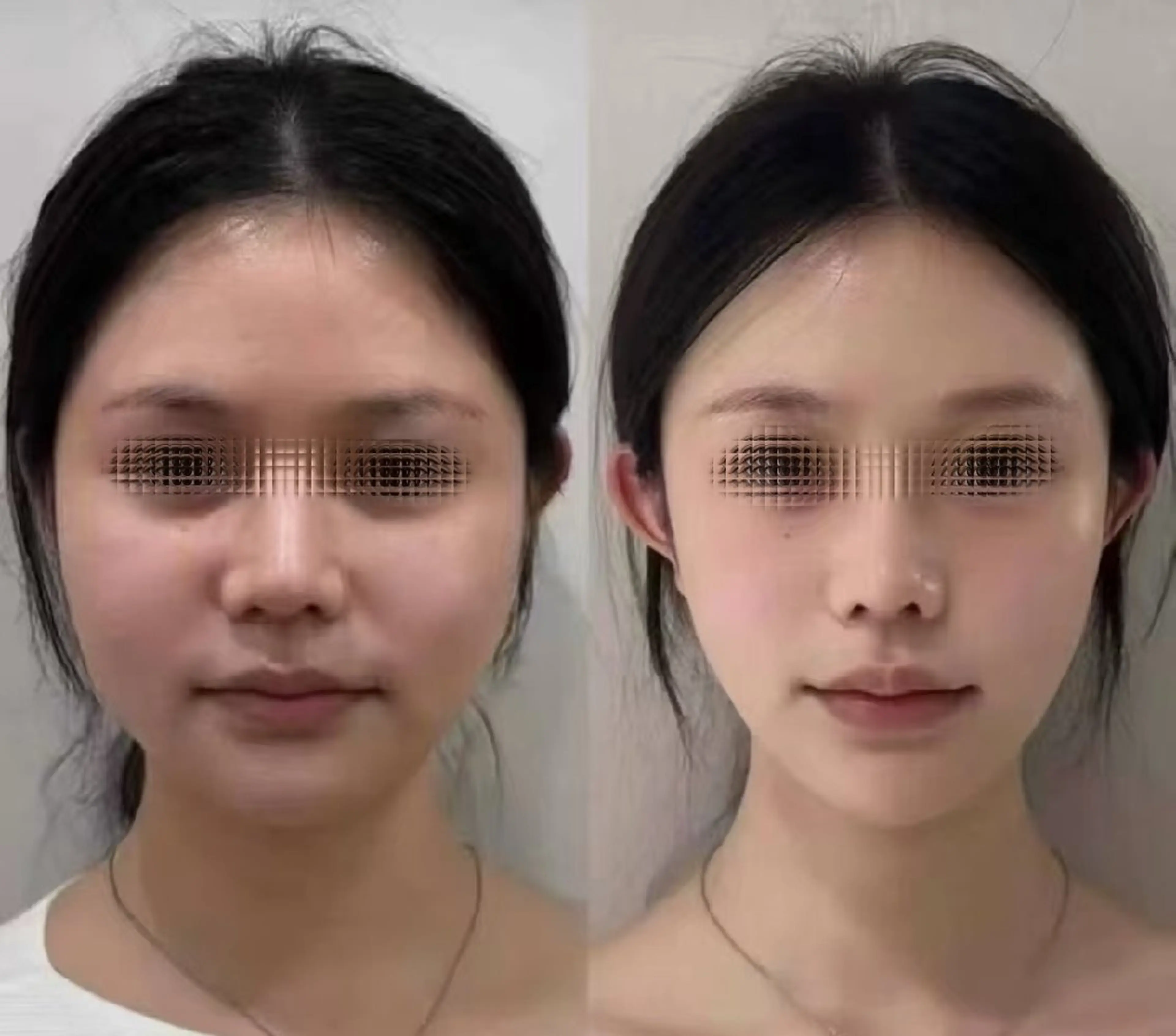 マツエク・マツパ 結婚式・ブライダル aliaハイフ&水光ジェットサロン所属・aliaハーブ水光店 エステティシャン募集のエステ・リラクイメージ