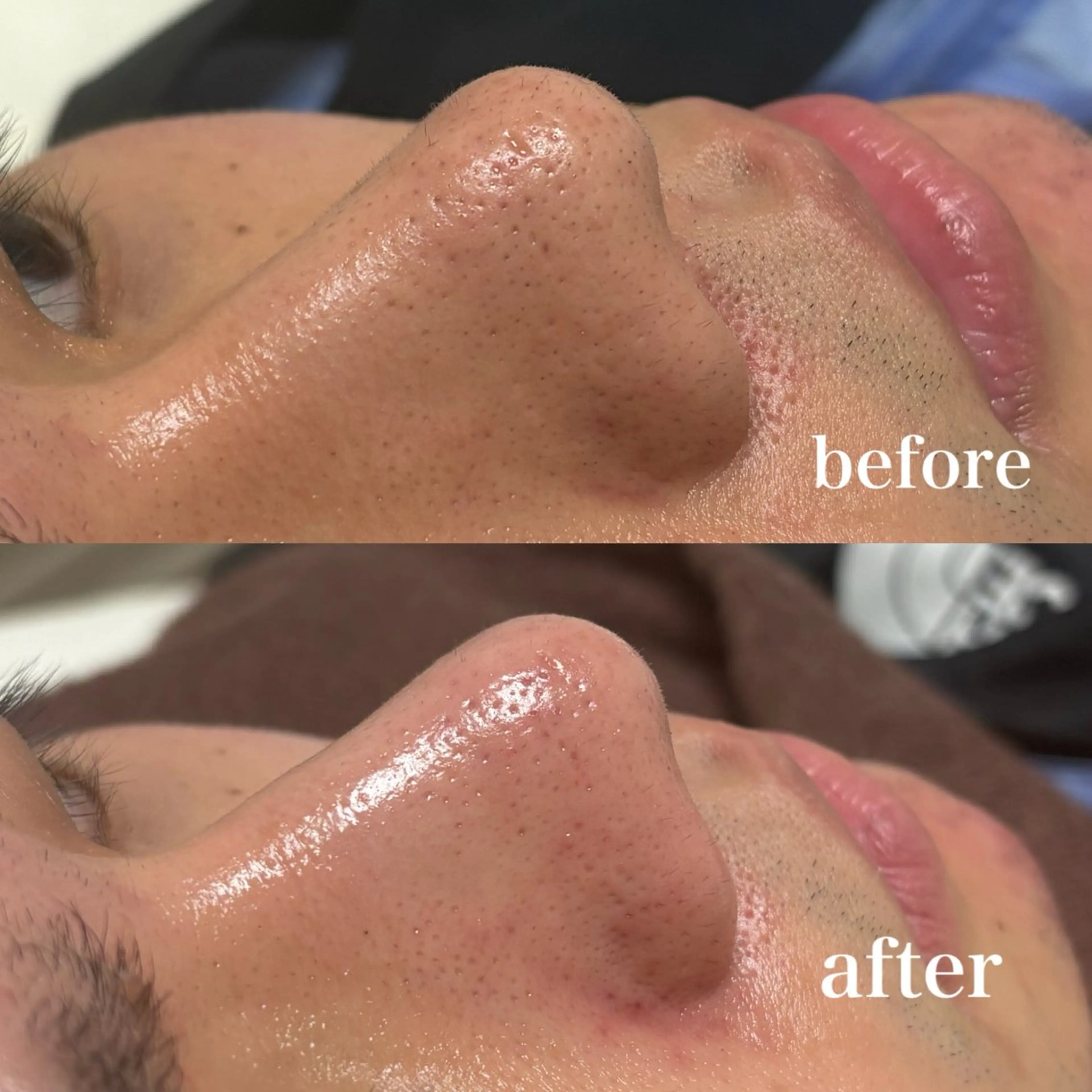 エステ 美養HAREHADA 🫧/ Ibukiの眉毛・アイブロウイメージ