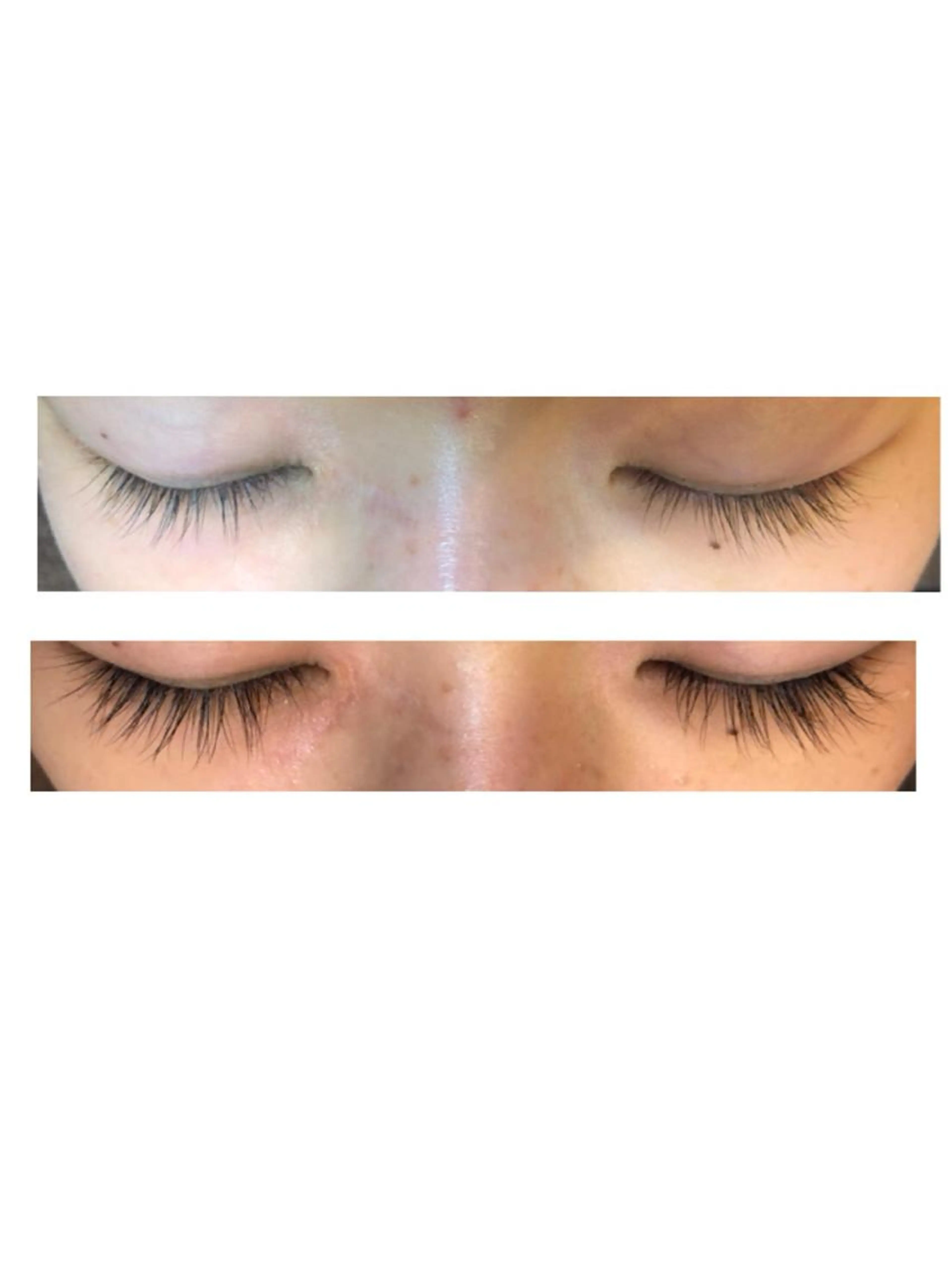 ラッシュアデクト まつ毛スキンケア❤️自まつ毛が多く濃く長くなり目元の印象を変える女性らしさの必須ケアの写真