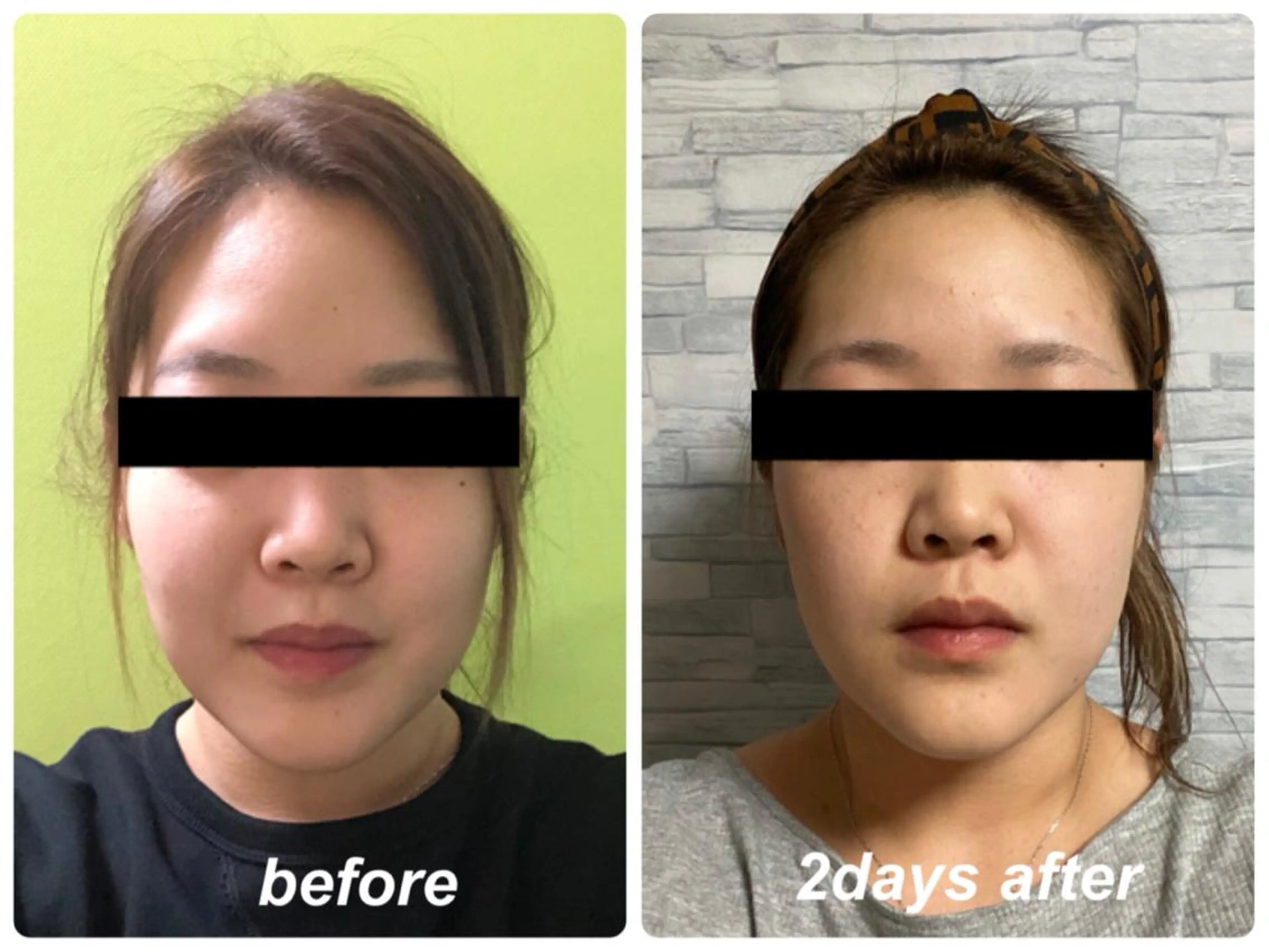 Radiance H.Oのエステ・リラクイメージ