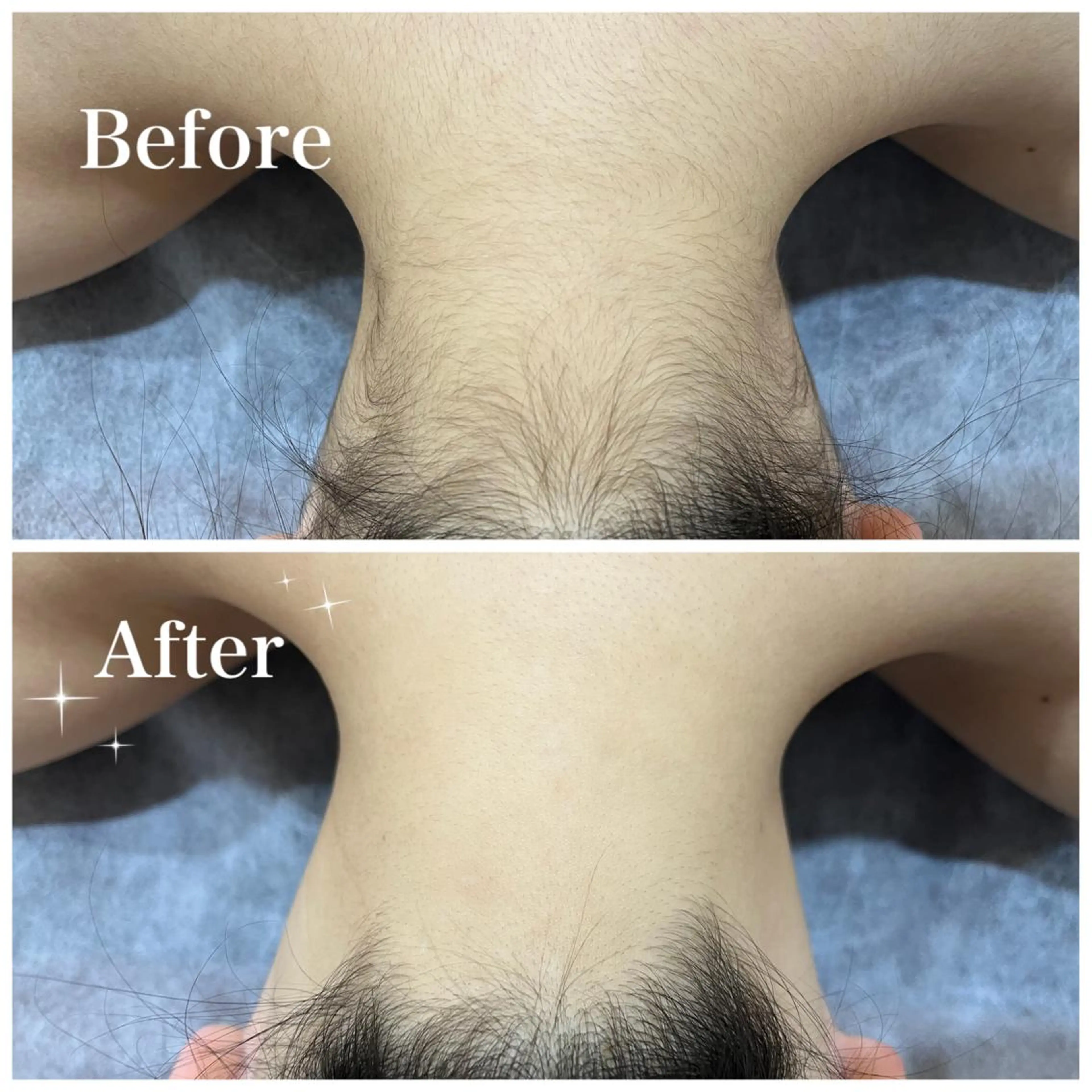 脱毛 脱毛サロン fam.豊澤柚良のエステ・リラクイメージ