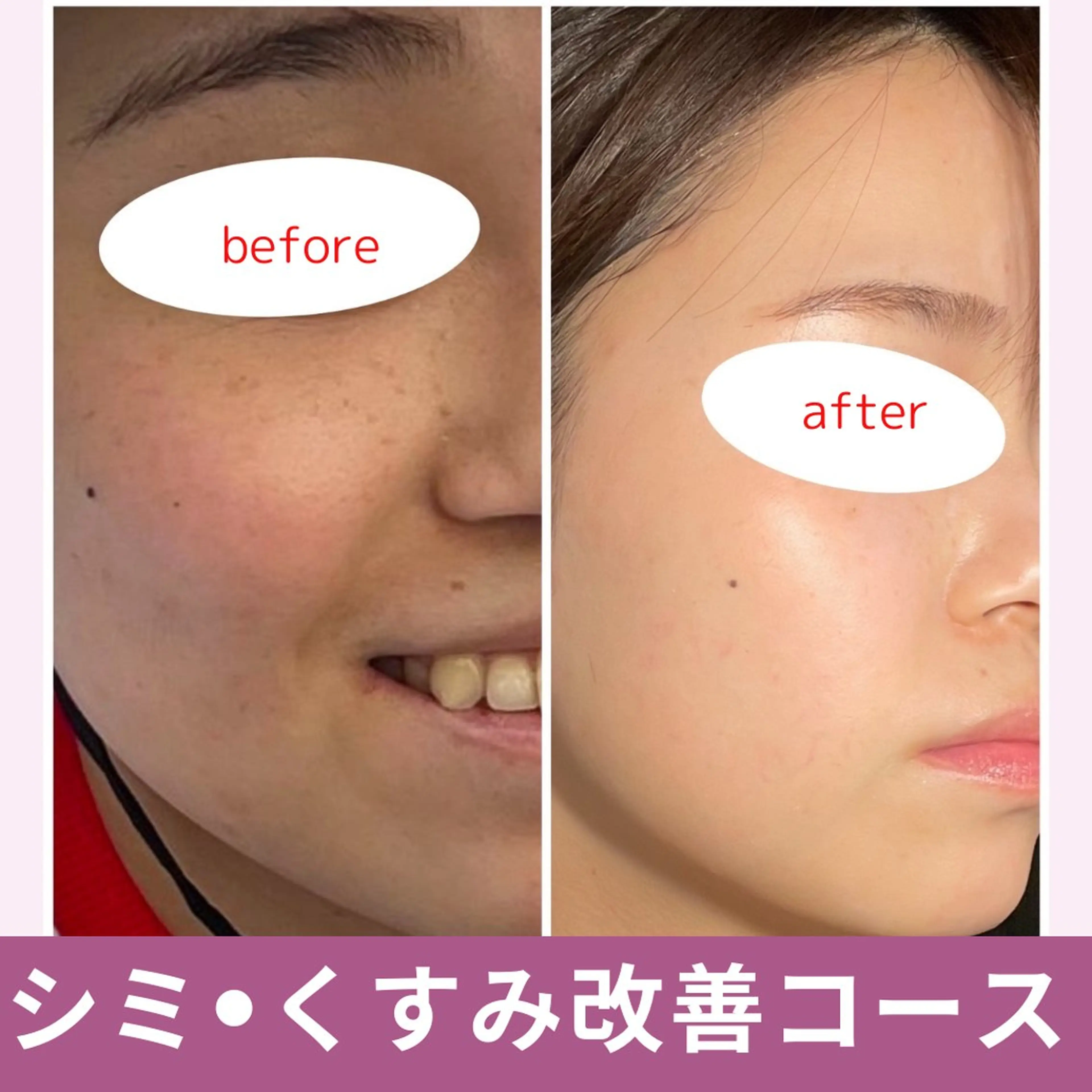 leolo武蔵浦和 肌質改善＆脱毛のエステ・リラクイメージ