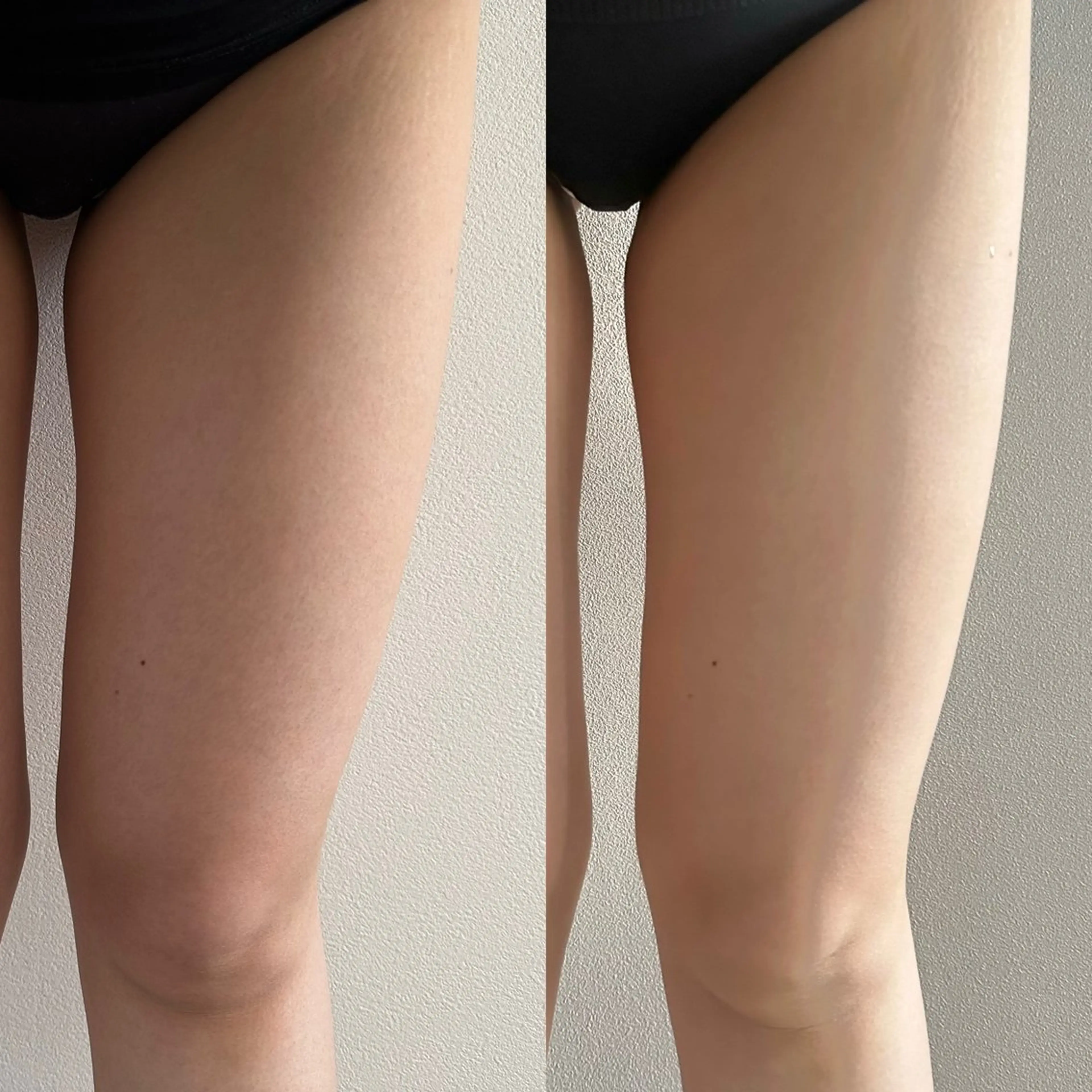 エステ Re.terna 岩井のその他イメージ