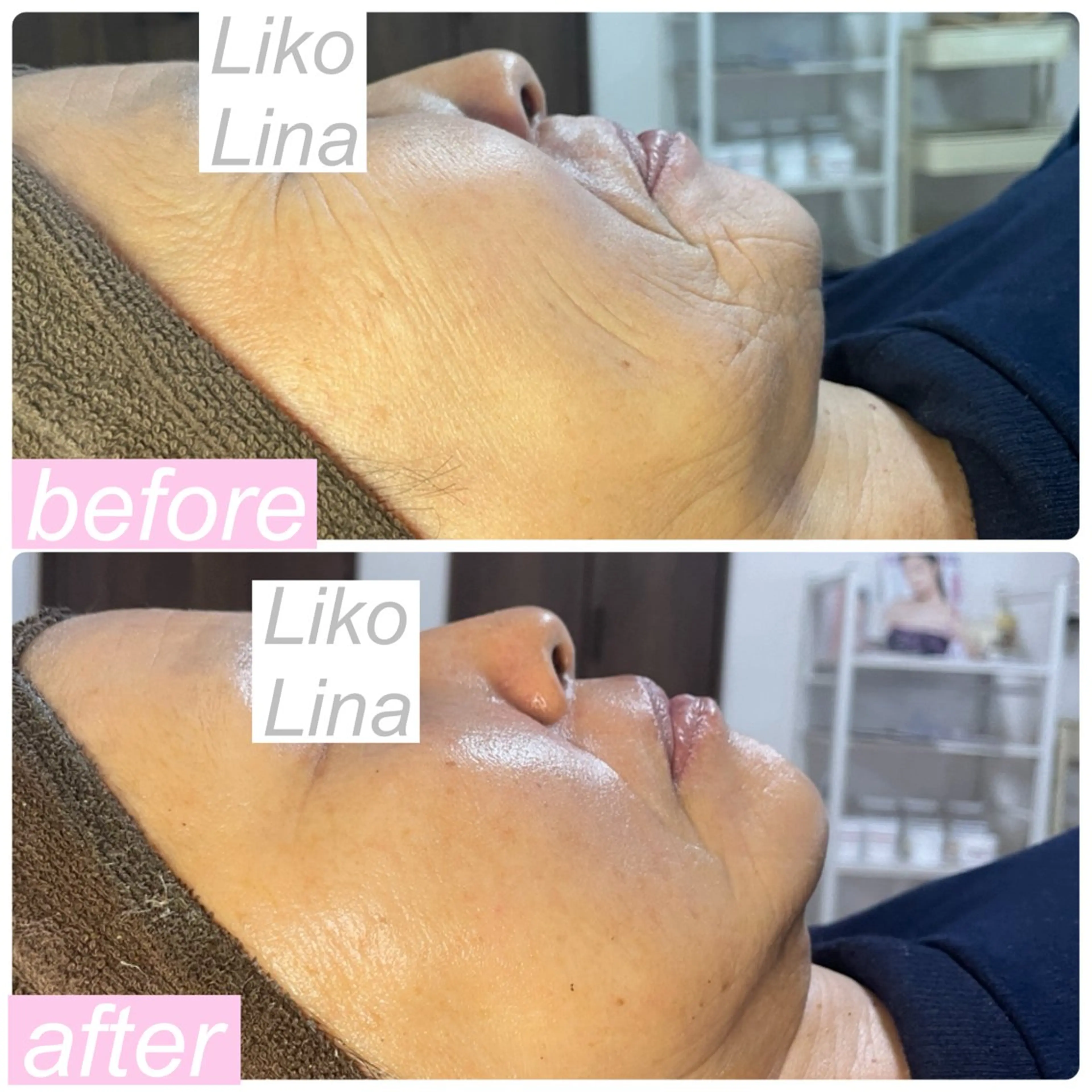 エステ 肌育脱毛サロン LikoLinaのその他イメージ