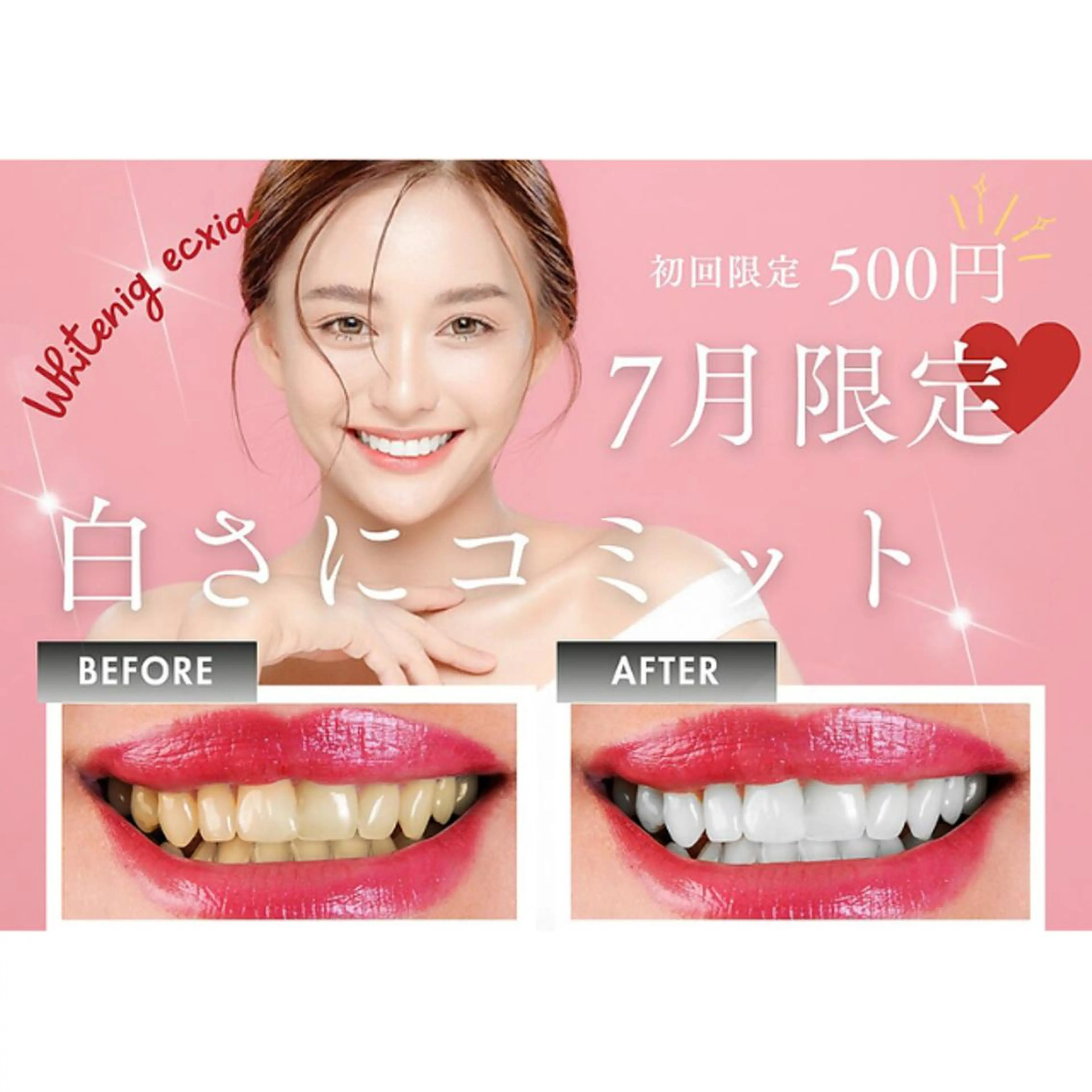 【口コミ投稿でお得☆】セルフホワイトニング(9分2セット)　1回¥3,980→¥500の写真