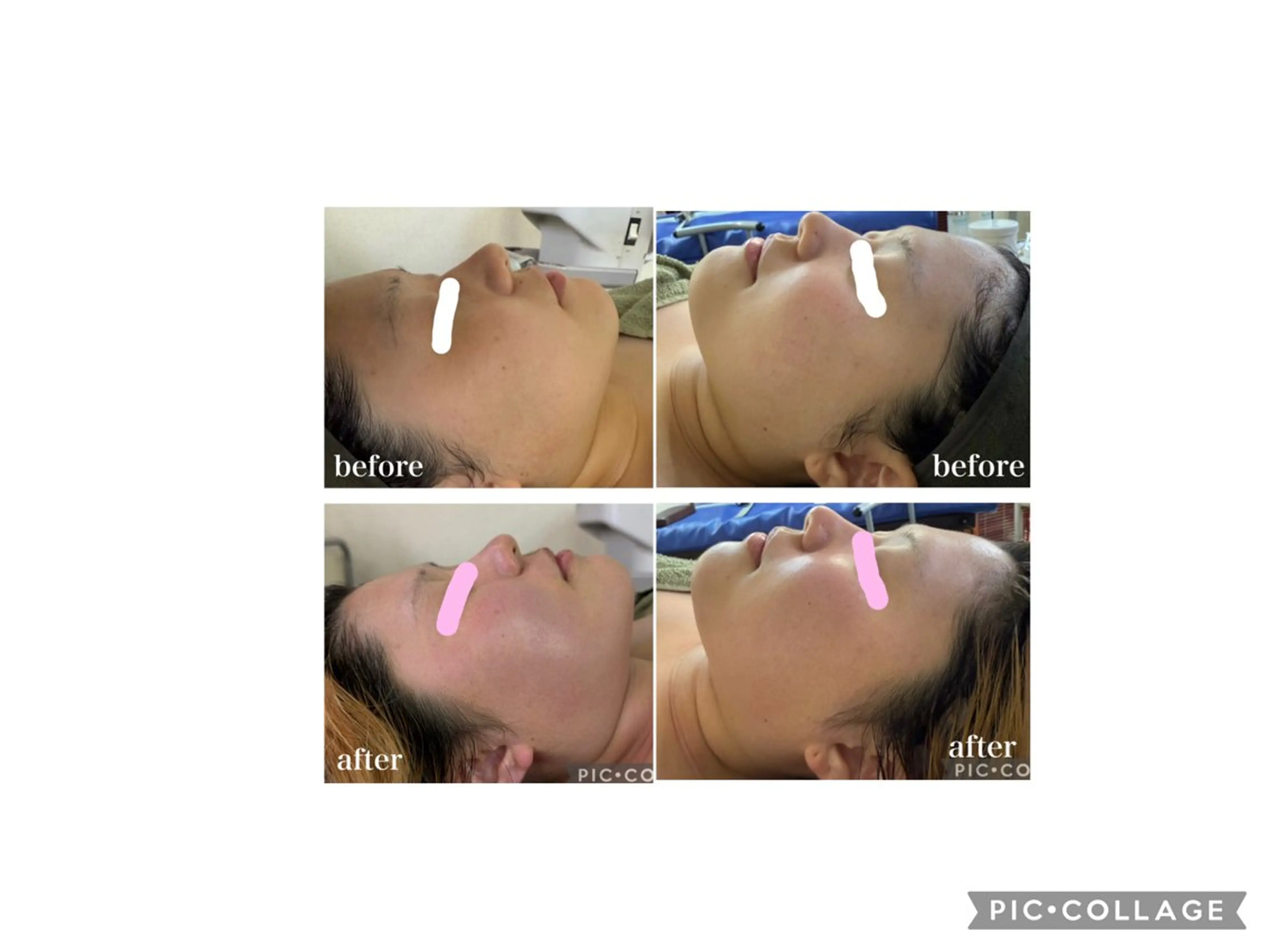 お顔もお身体も美しく Nanalaの眉毛・アイブロウイメージ