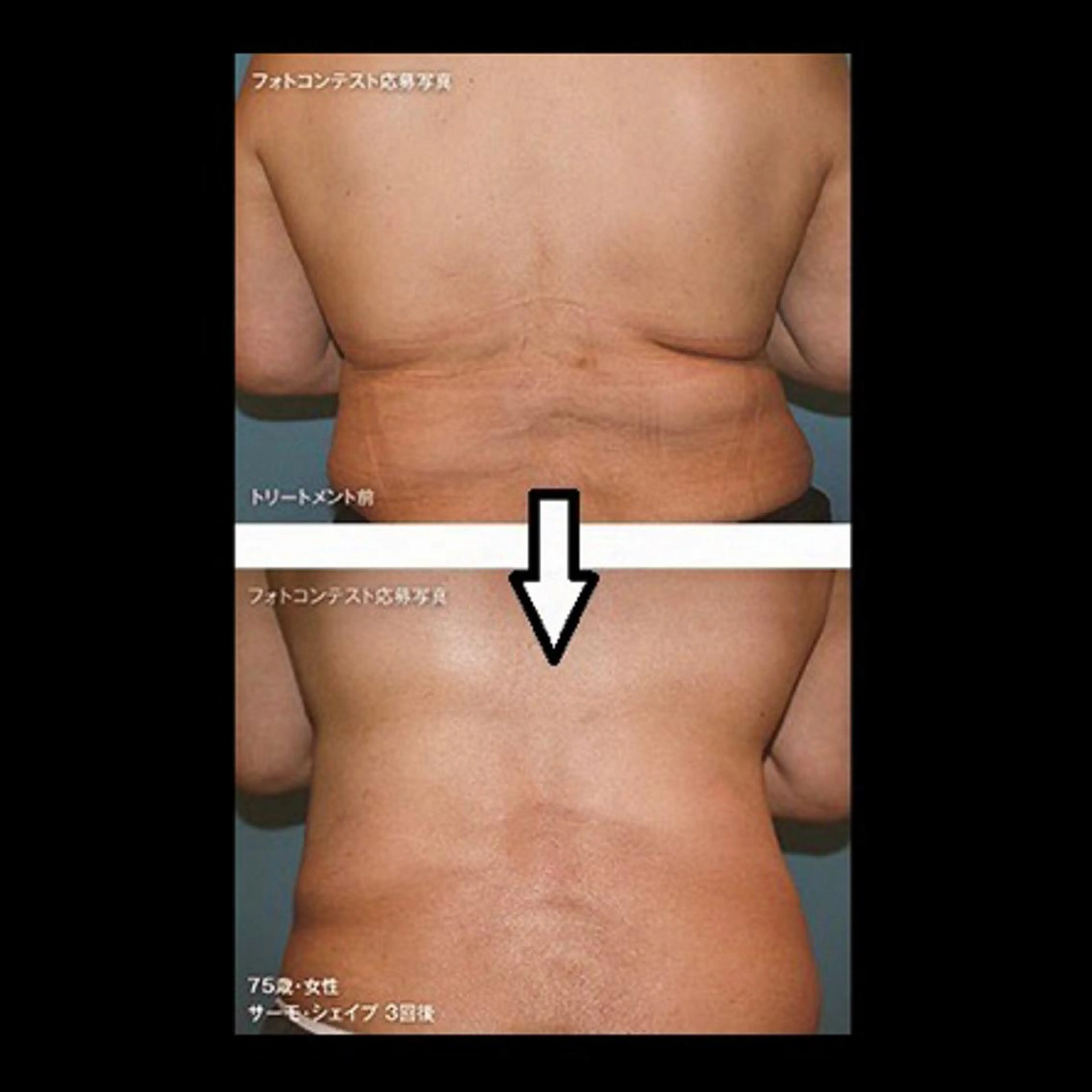 くびれ作り専門サロン こねこのシッポ虎ノ門のエステ・リラクイメージ