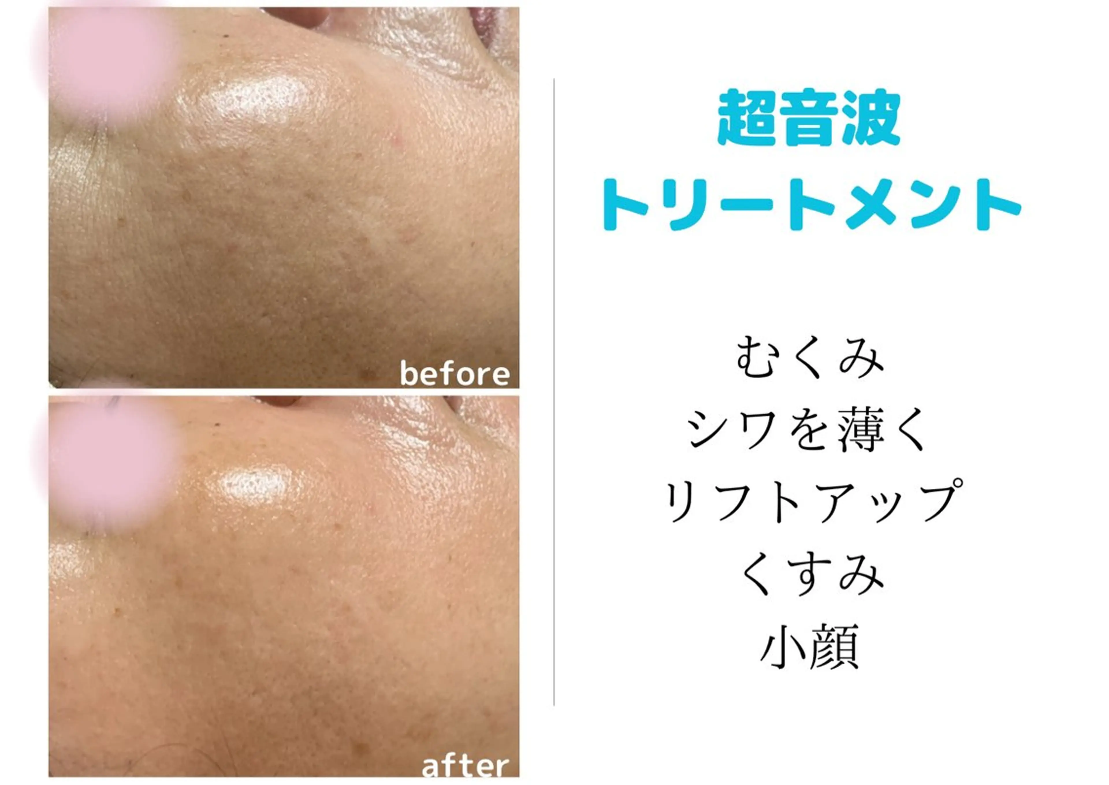 エステ リラク プライベートサロンCuara所属・プライベートサロン Cuaraのエステ・リラクイメージ