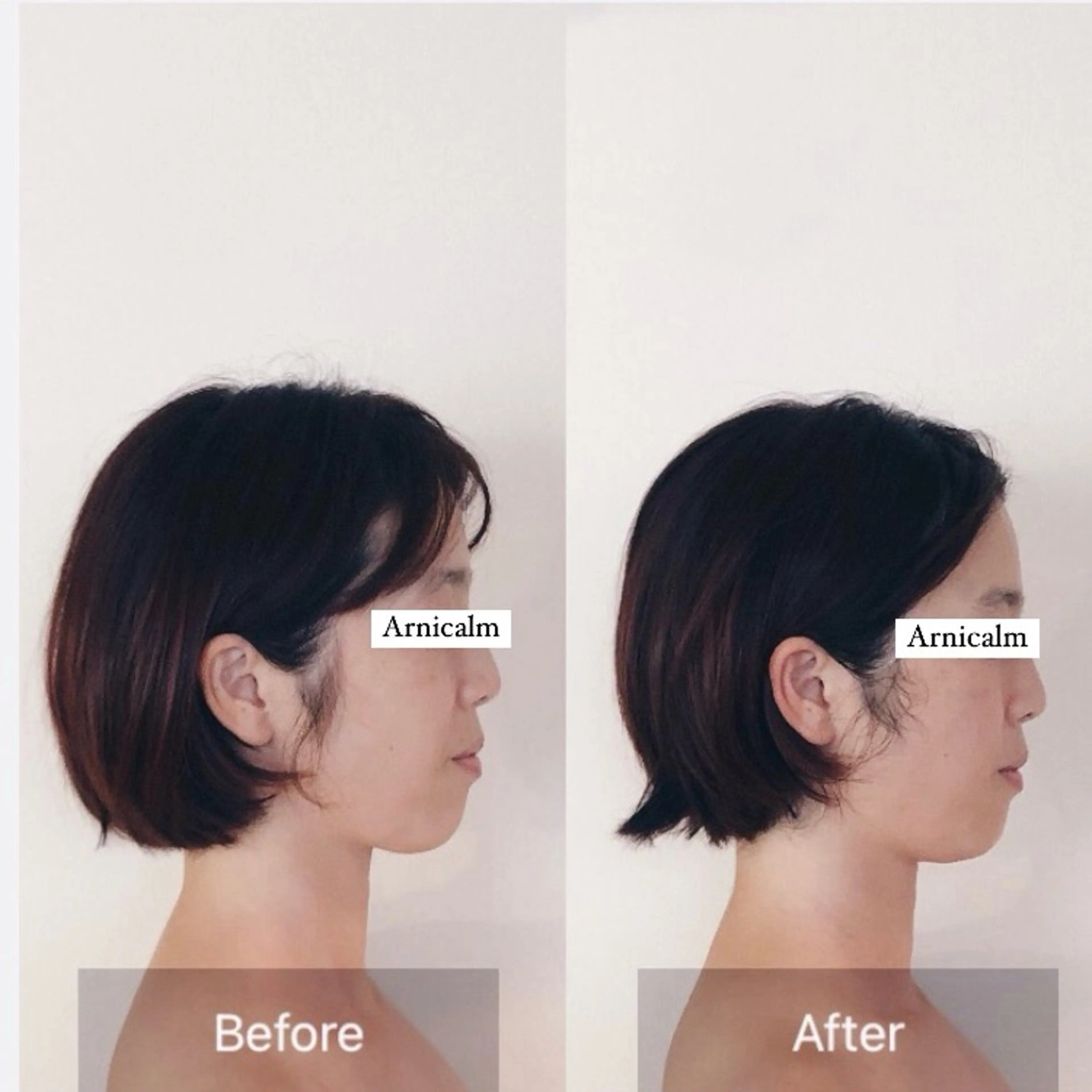 ハーブピーリング 肌再生ピーリング/のエステ・リラクイメージ